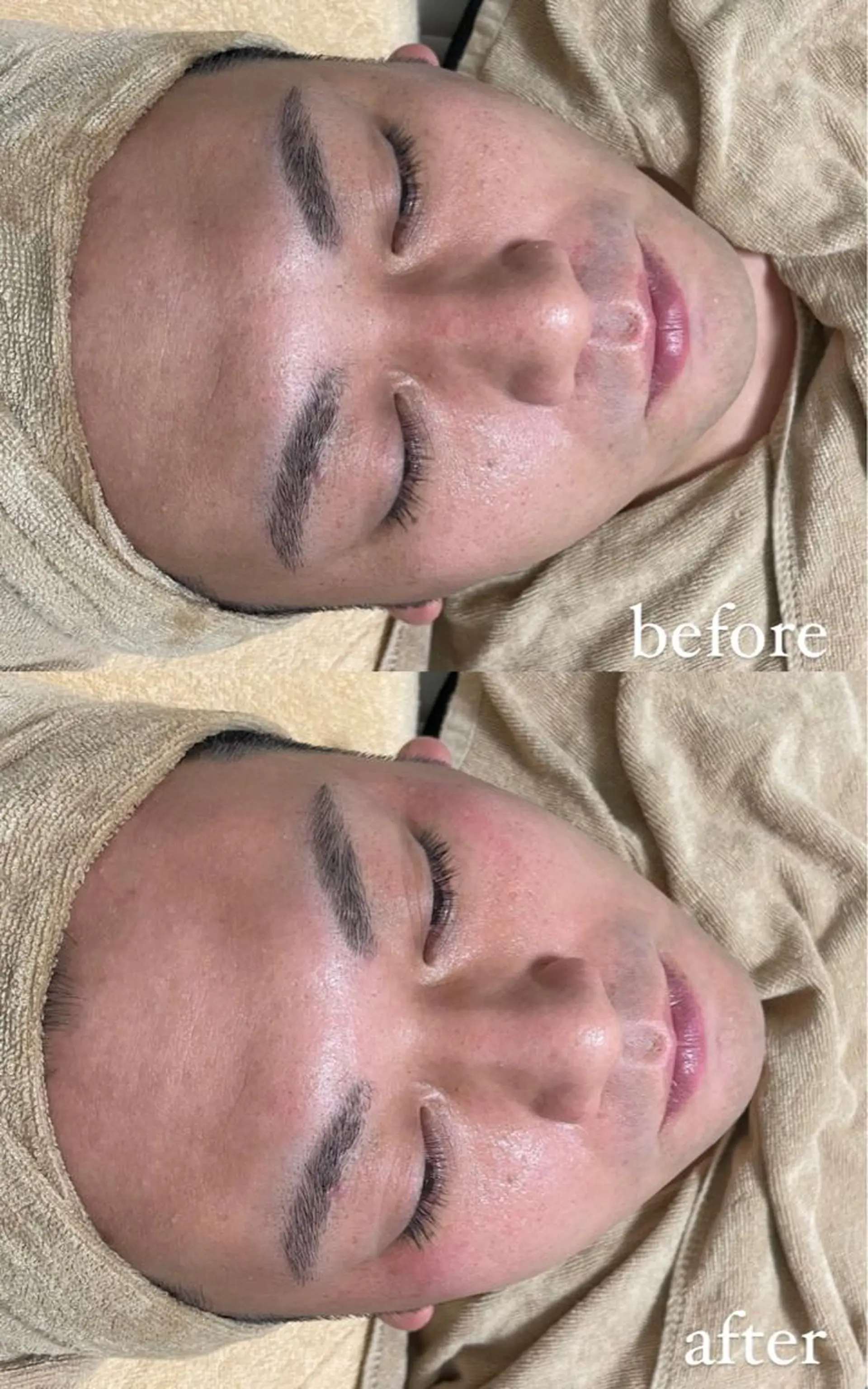 脱毛 エステサロン Mi-mi.iのエステ・リラクイメージ