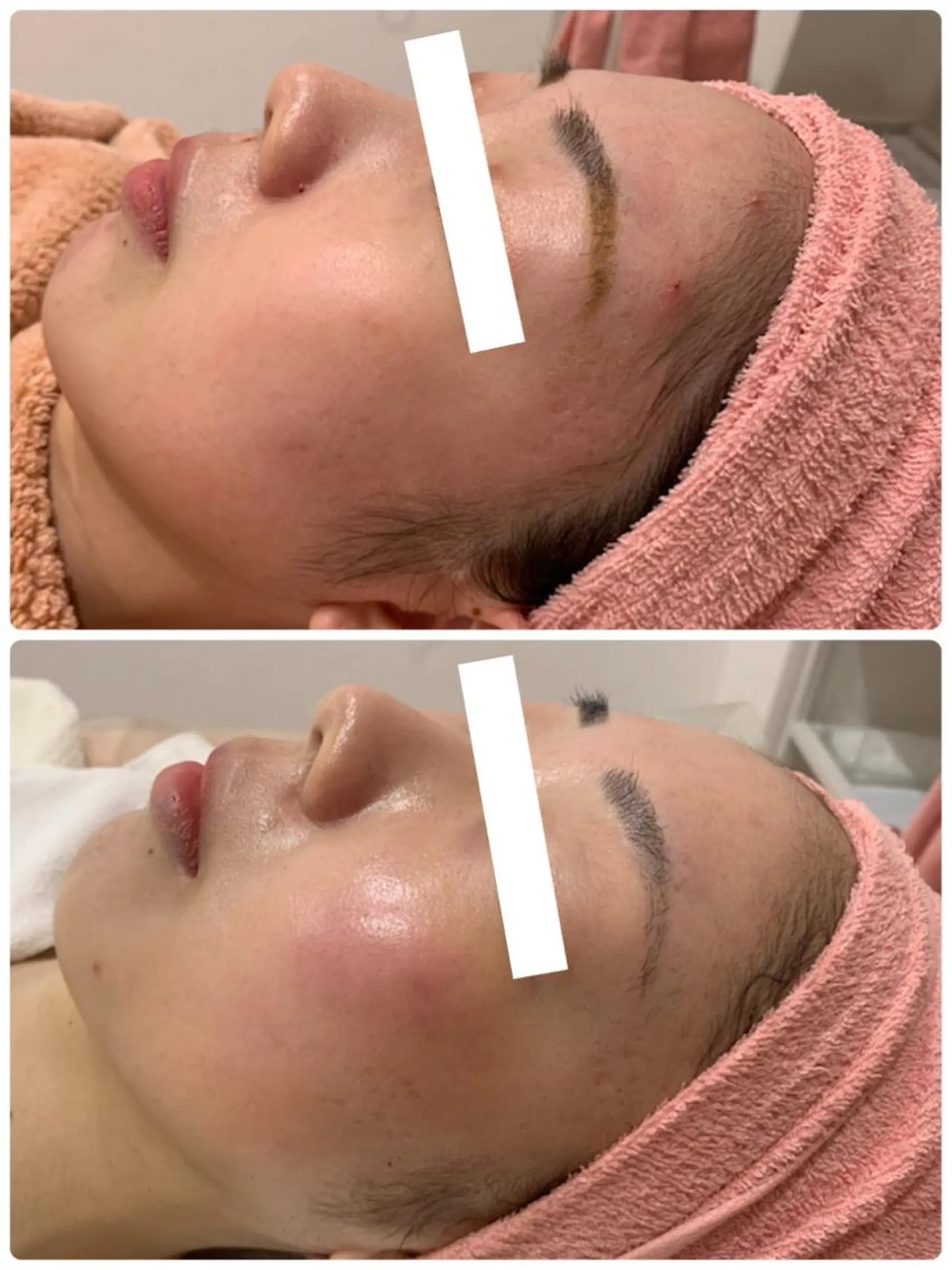 エステ 産後/ツヤ肌/子連れ /保育士在籍サロンのエステ・リラクイメージ