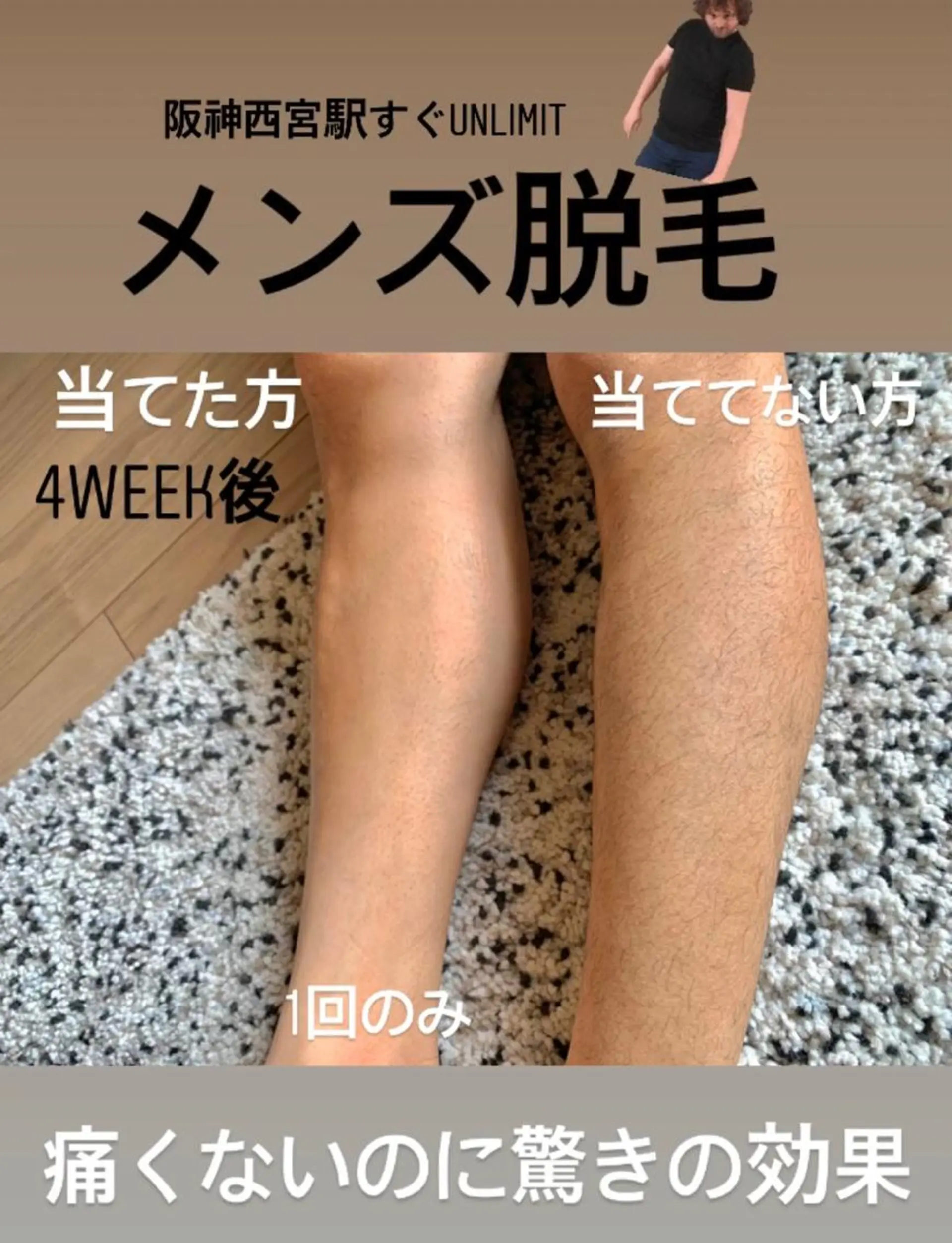 メンズ 脱毛＆エステサロン【アンリミット】所属・森谷 莉美のエステ・リラクイメージ