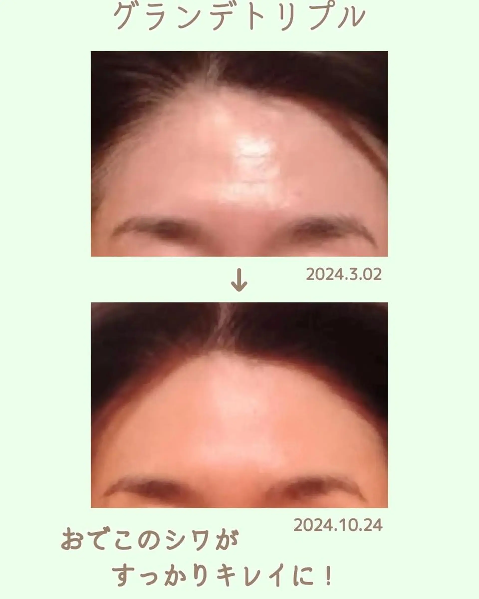 ラブニール 恵比寿店のエステ・リラクイメージ