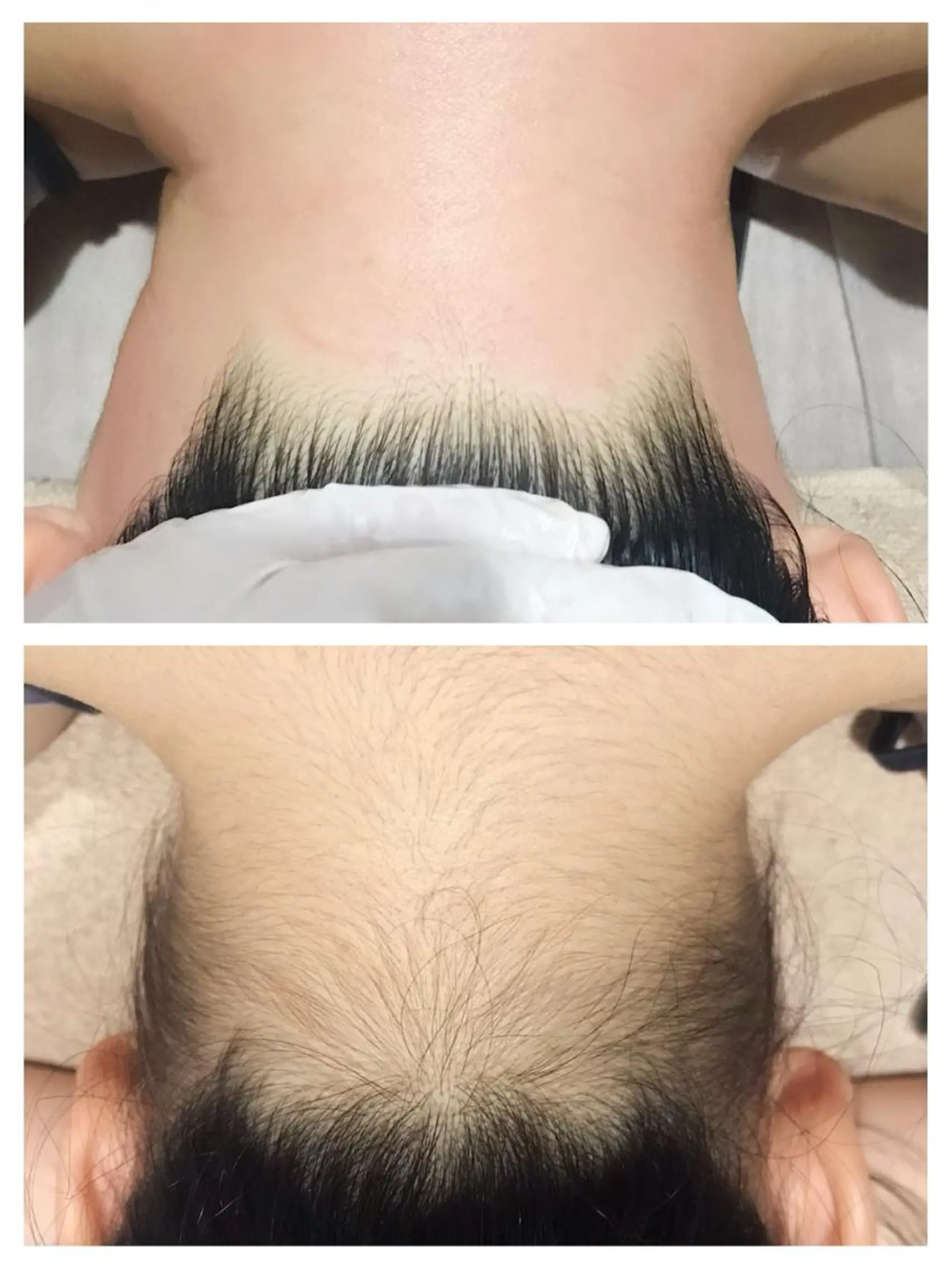 脱毛 Beauty salon 十美所属・【 十美 】 ENDOのエステ・リラクイメージ