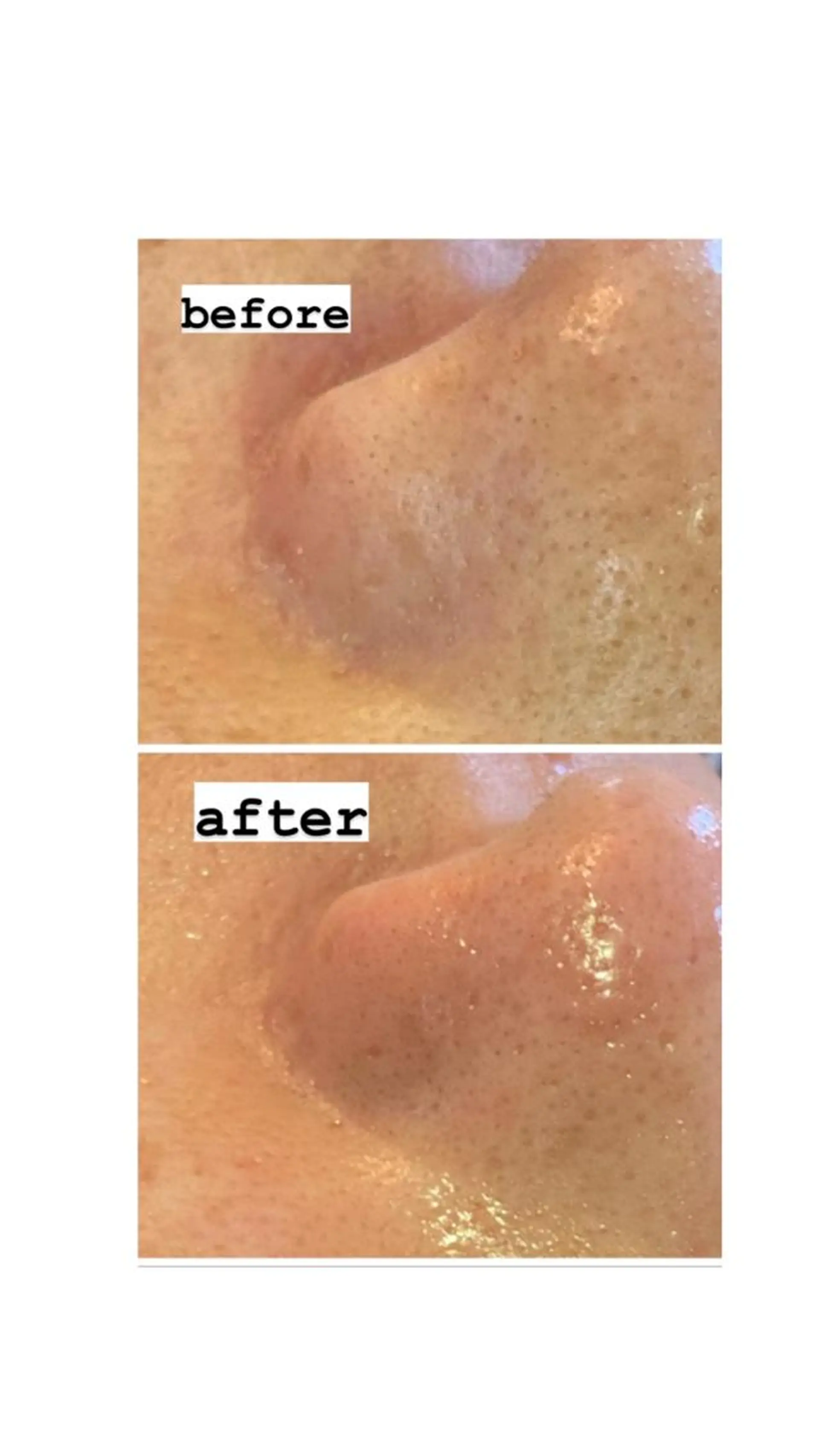 脱毛・エステサロン LuLuNのエステ・リラクイメージ