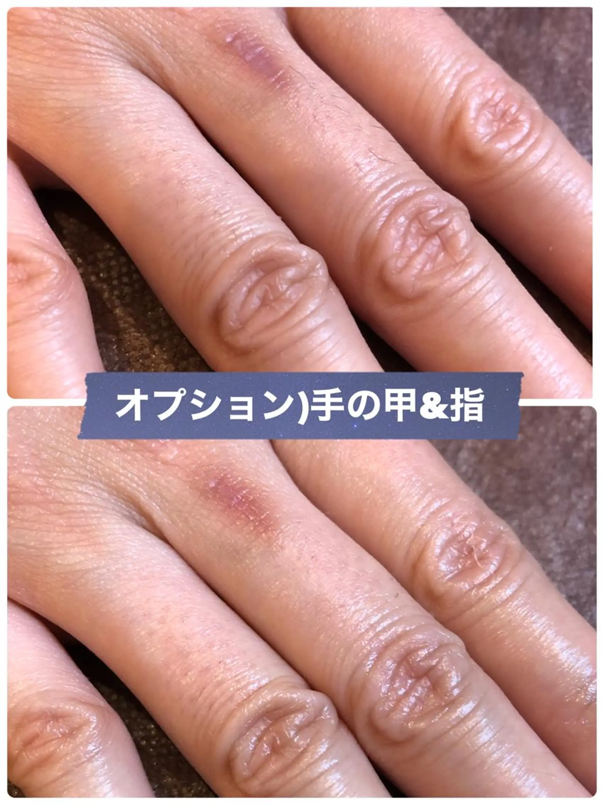 ブラジリアン☆WAX 🎖🌚YUKI🌚のエステ・リラクイメージ