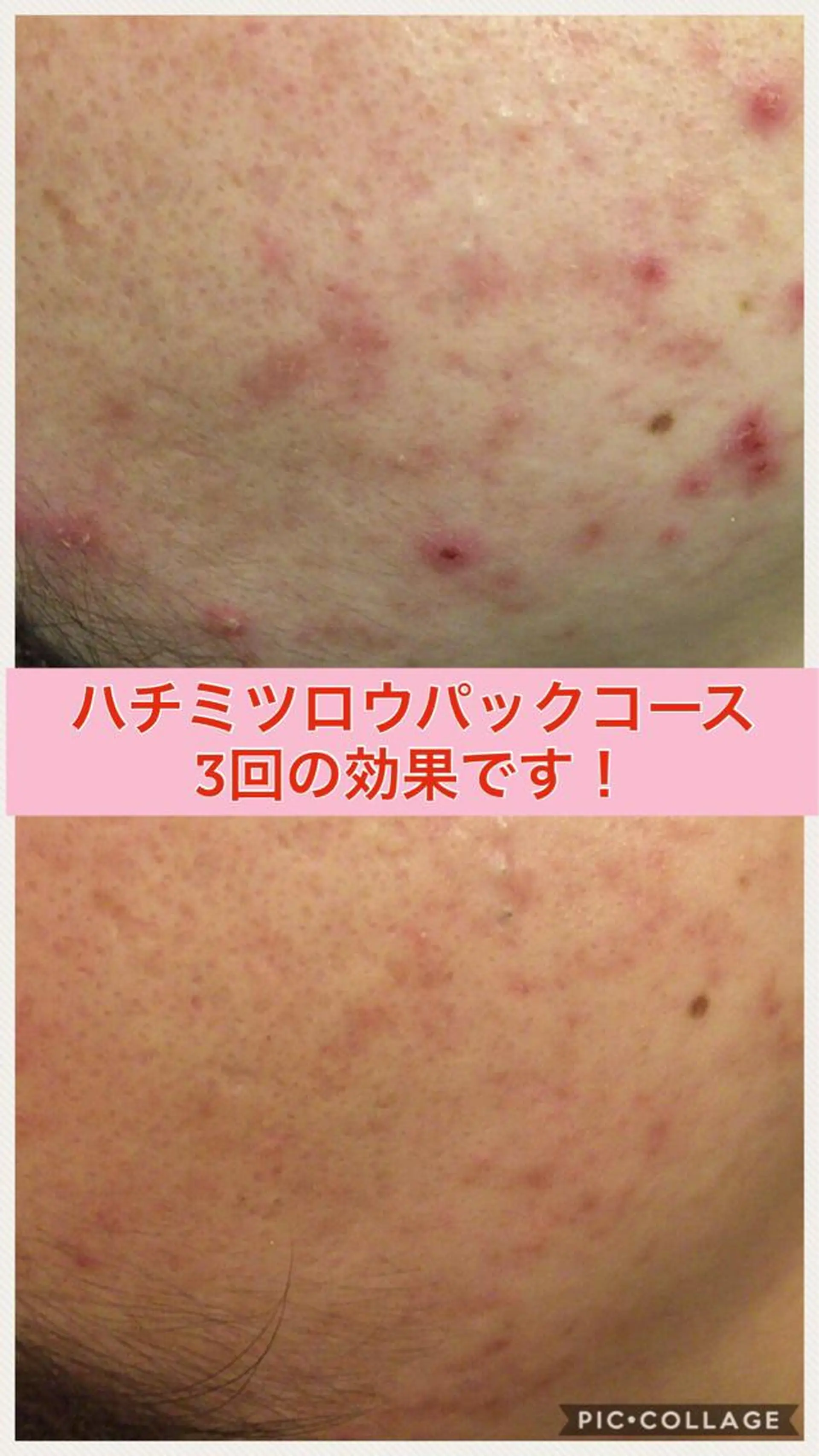 ショート カラー パーマ ヘアアレンジ メンズ キッズ ネイル マツエク・マツパ ニキビ・肌質改善専門 ♡人生が変わるサロンのエステ・リラクイメージ