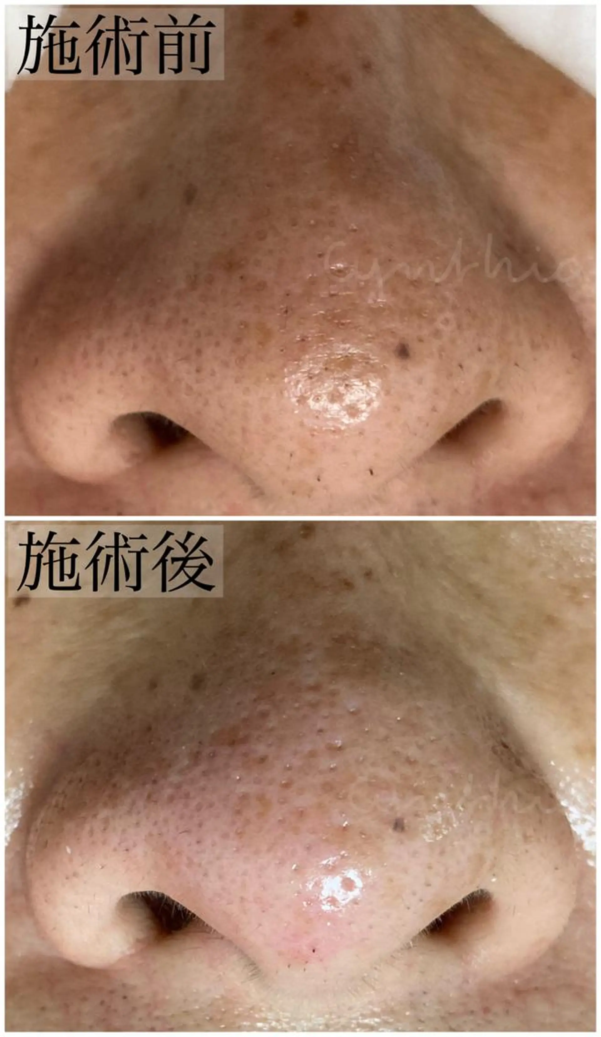 毛穴ケア専門店 Cynthiaのエステ・リラクイメージ