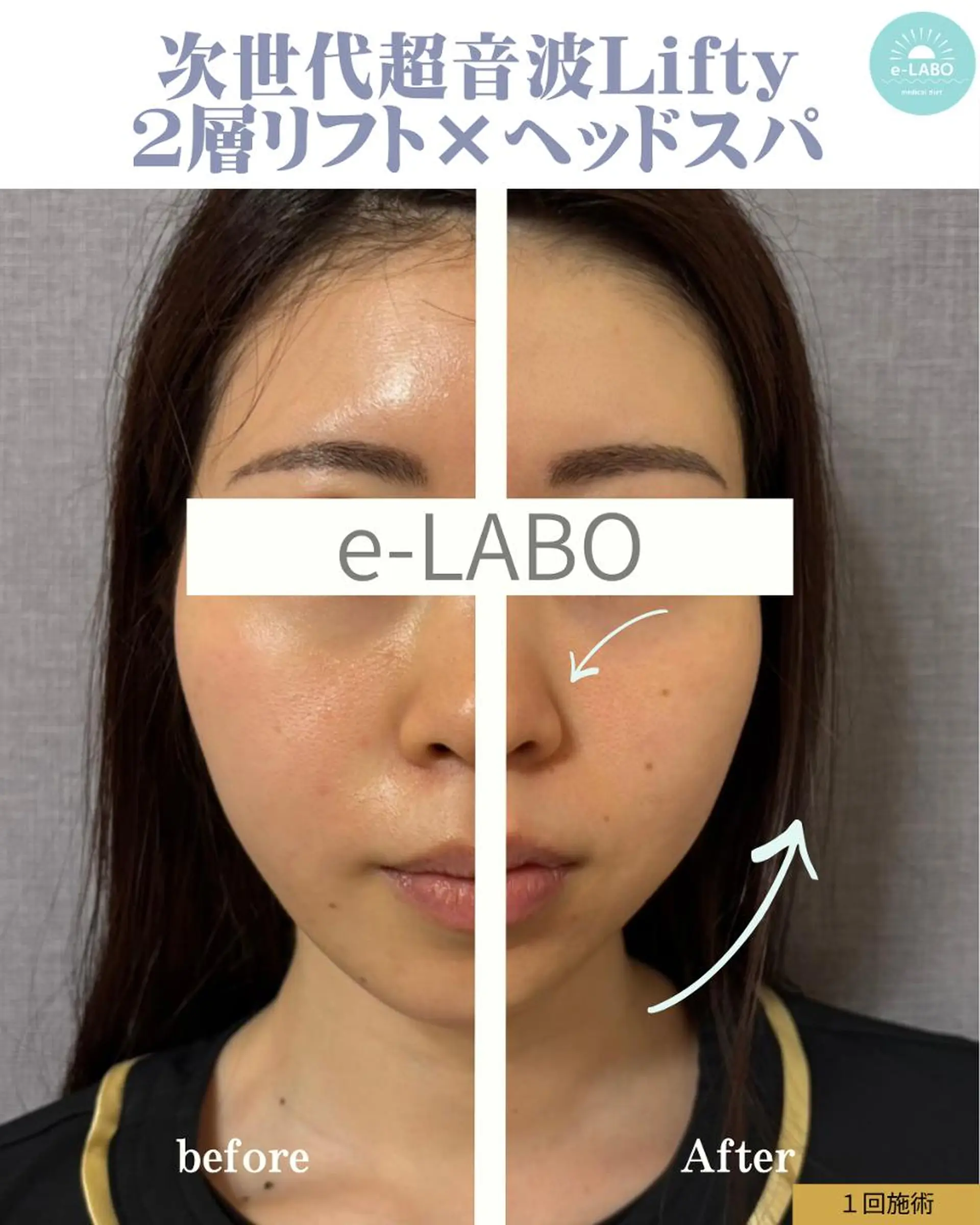 エステ e-LABO 池袋のエステ・リラクイメージ