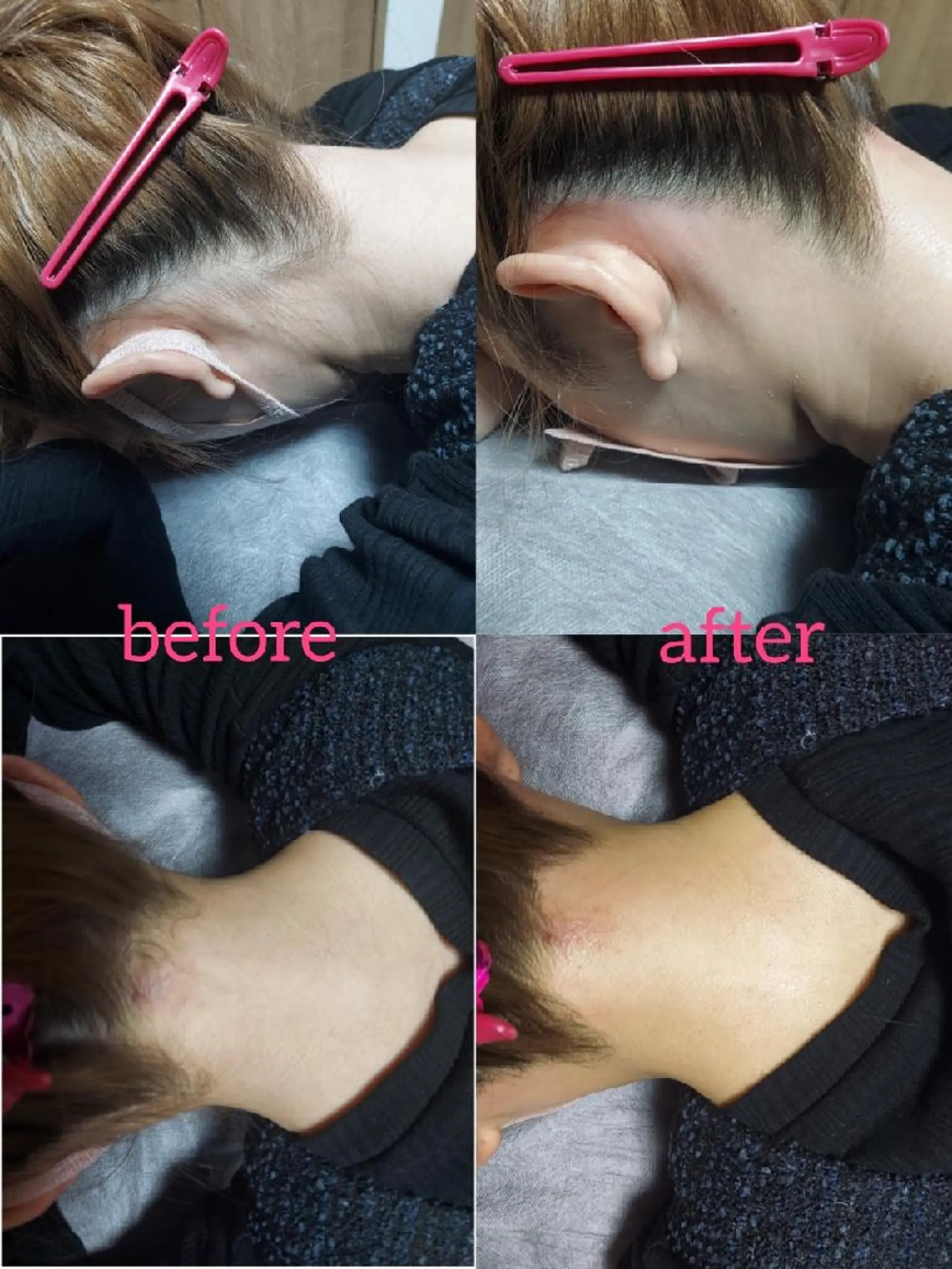 脱毛サロンLULA 恵比寿店濱野のエステ・リラクイメージ