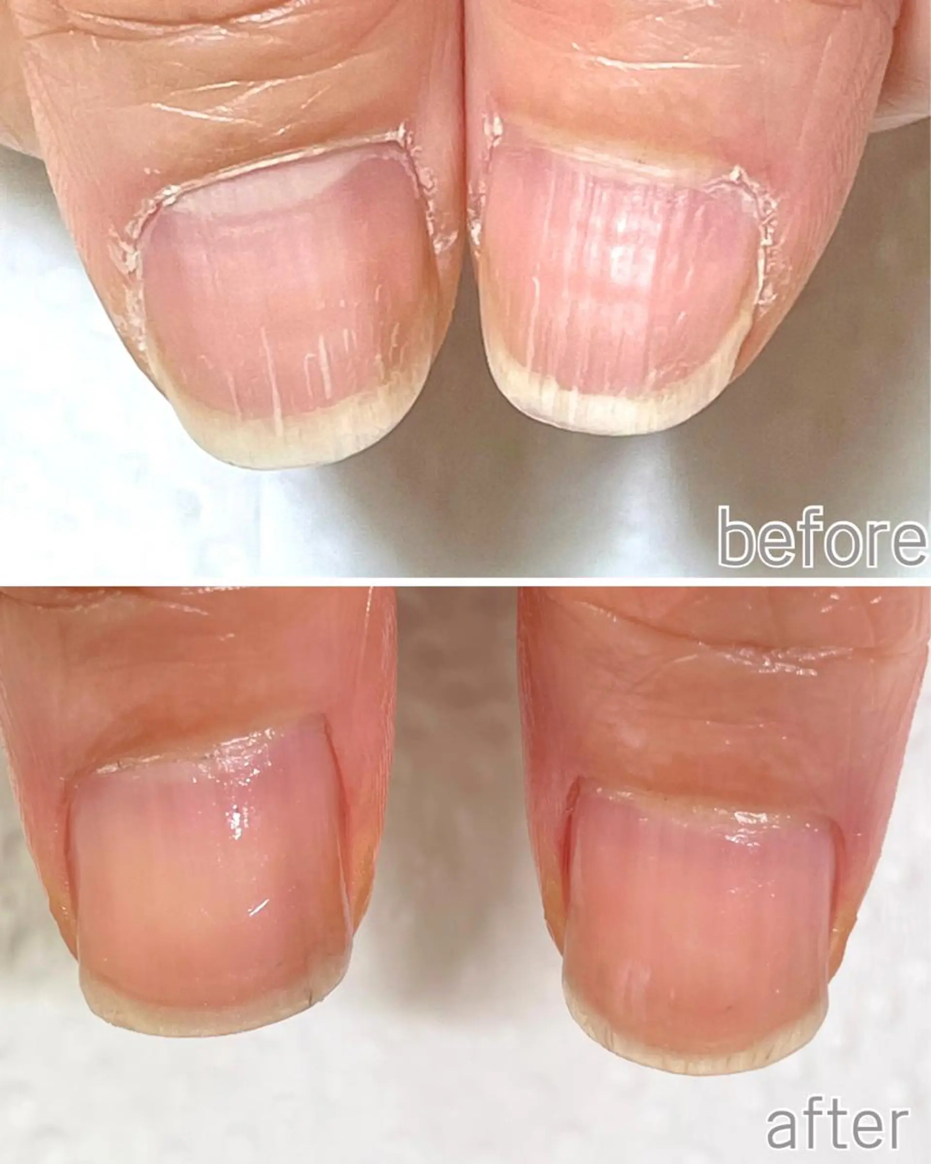 ネイル 自爪育成専門店Ka pilina所属・自爪育成専門店 Kapilinaのネイルデザイン