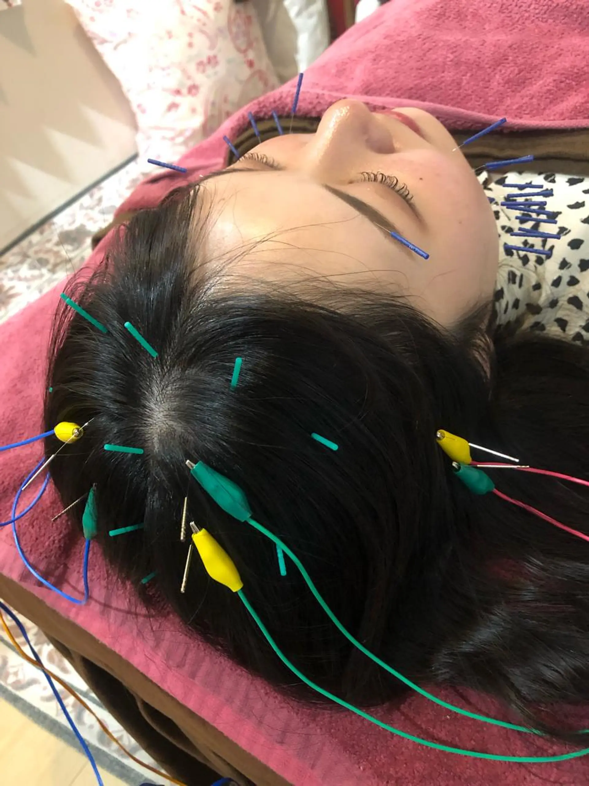 エステ リラク 美容鍼灸女性専用 りんご鍼灸治療院のその他イメージ