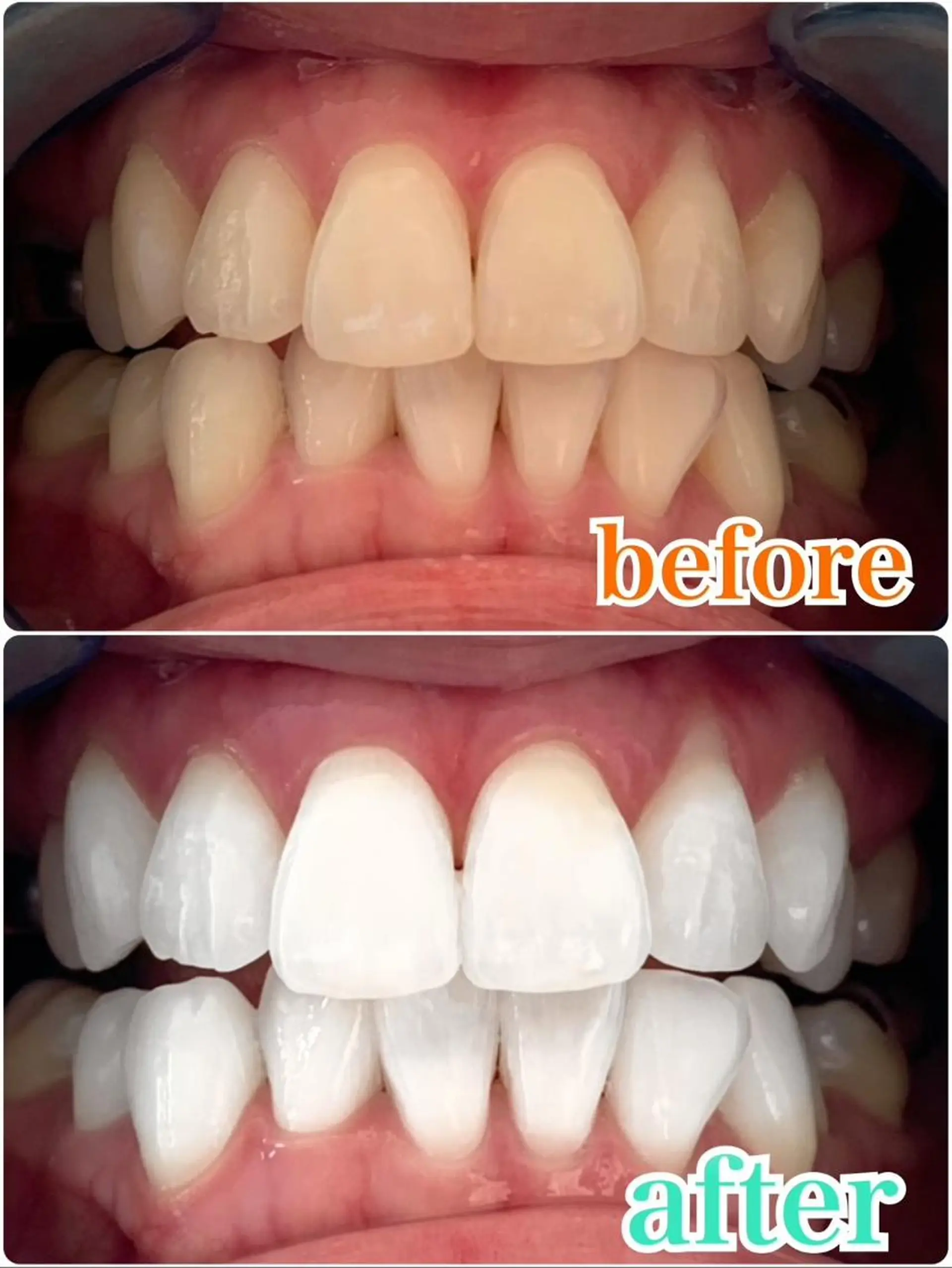 セミロング パーマ キッズ アイブロウ マツエク・マツパ メンズ カラー ヘアアレンジ ネイル エステ リラク ライトビューティー 銀座店のエステ・リラクイメージ