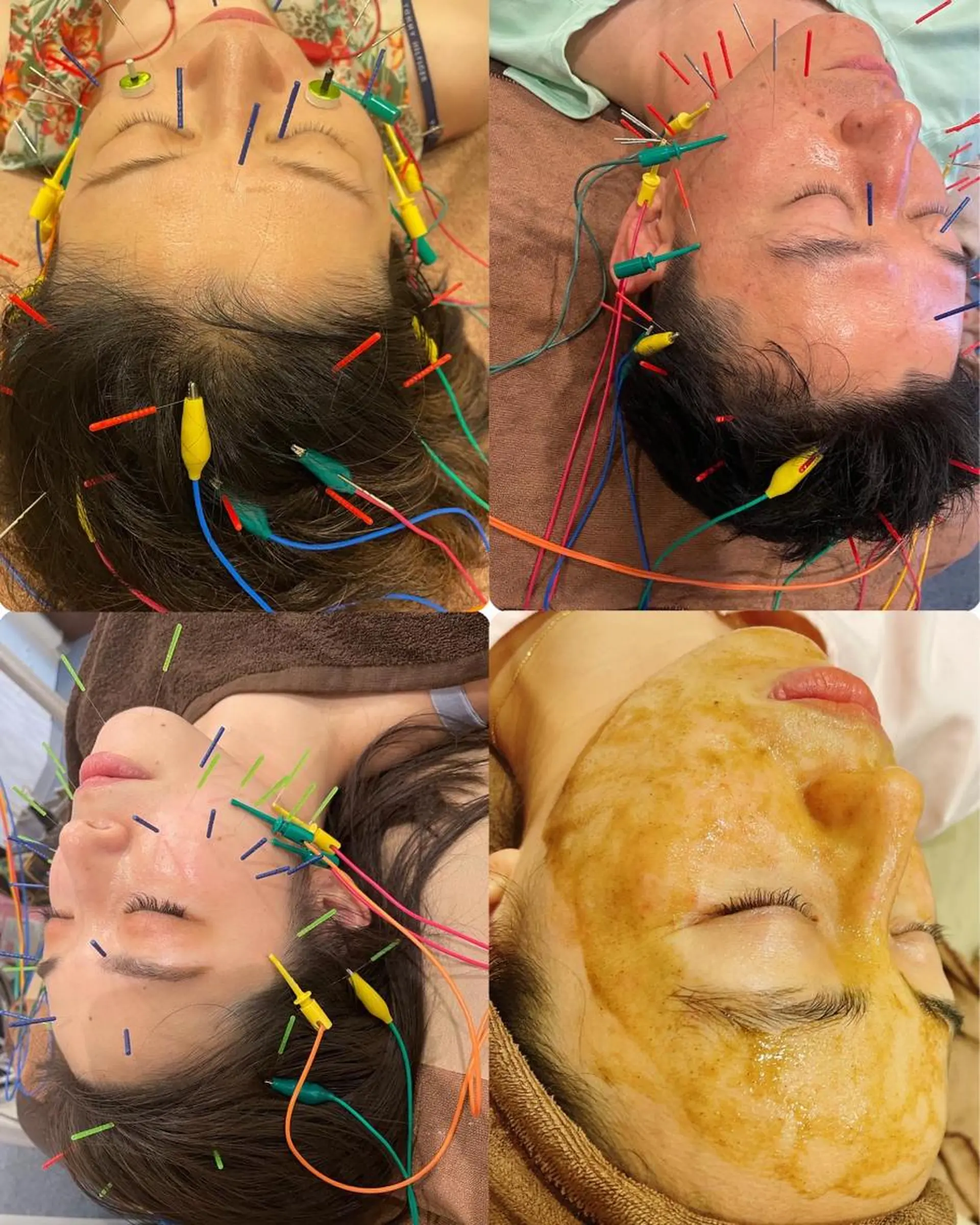 美容鍼灸サロン mahoroba院長のエステ・リラクイメージ