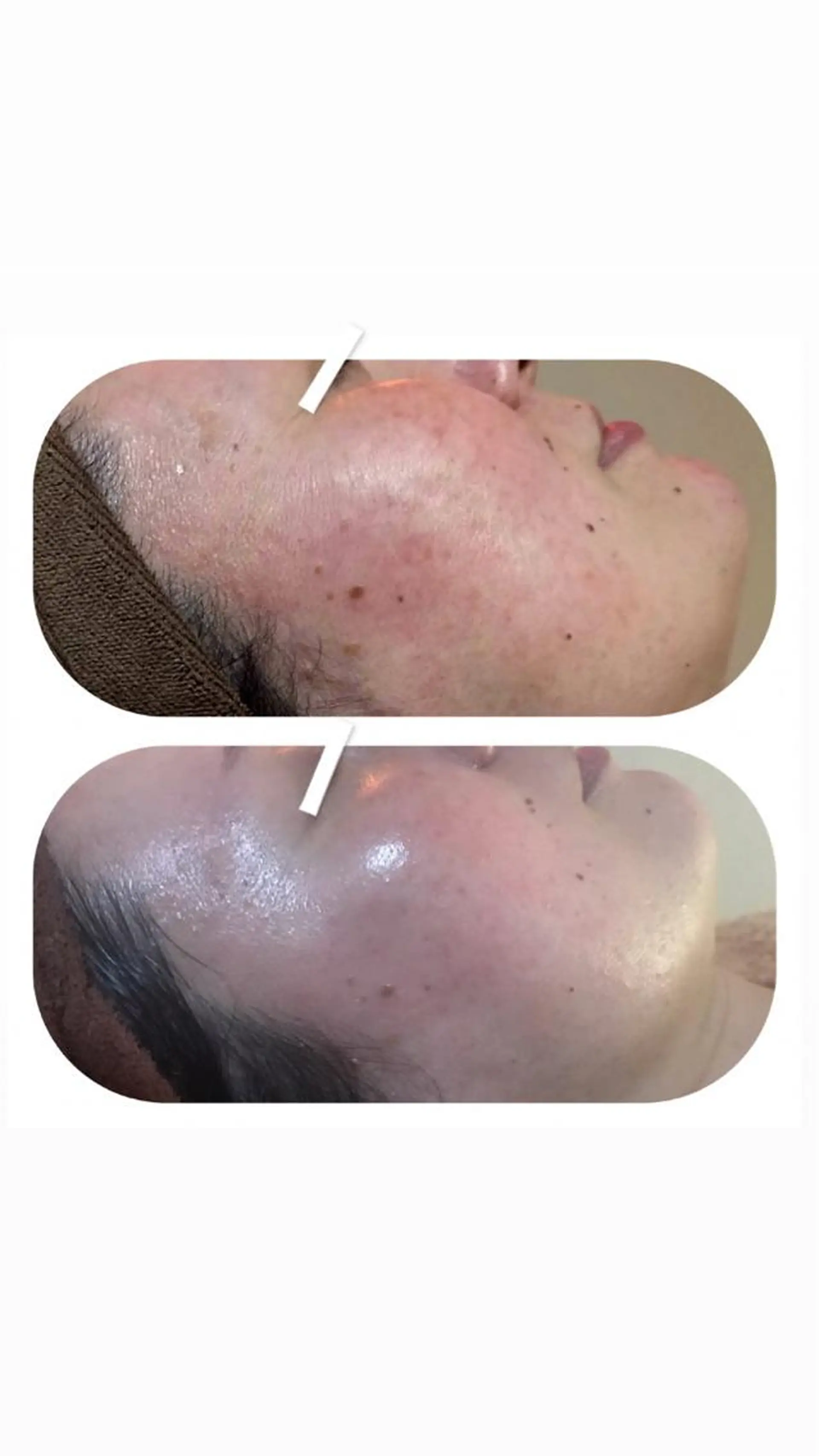 エステ 【足圧】鬼👹リンパ 身体整うサロンのエステ・リラクイメージ