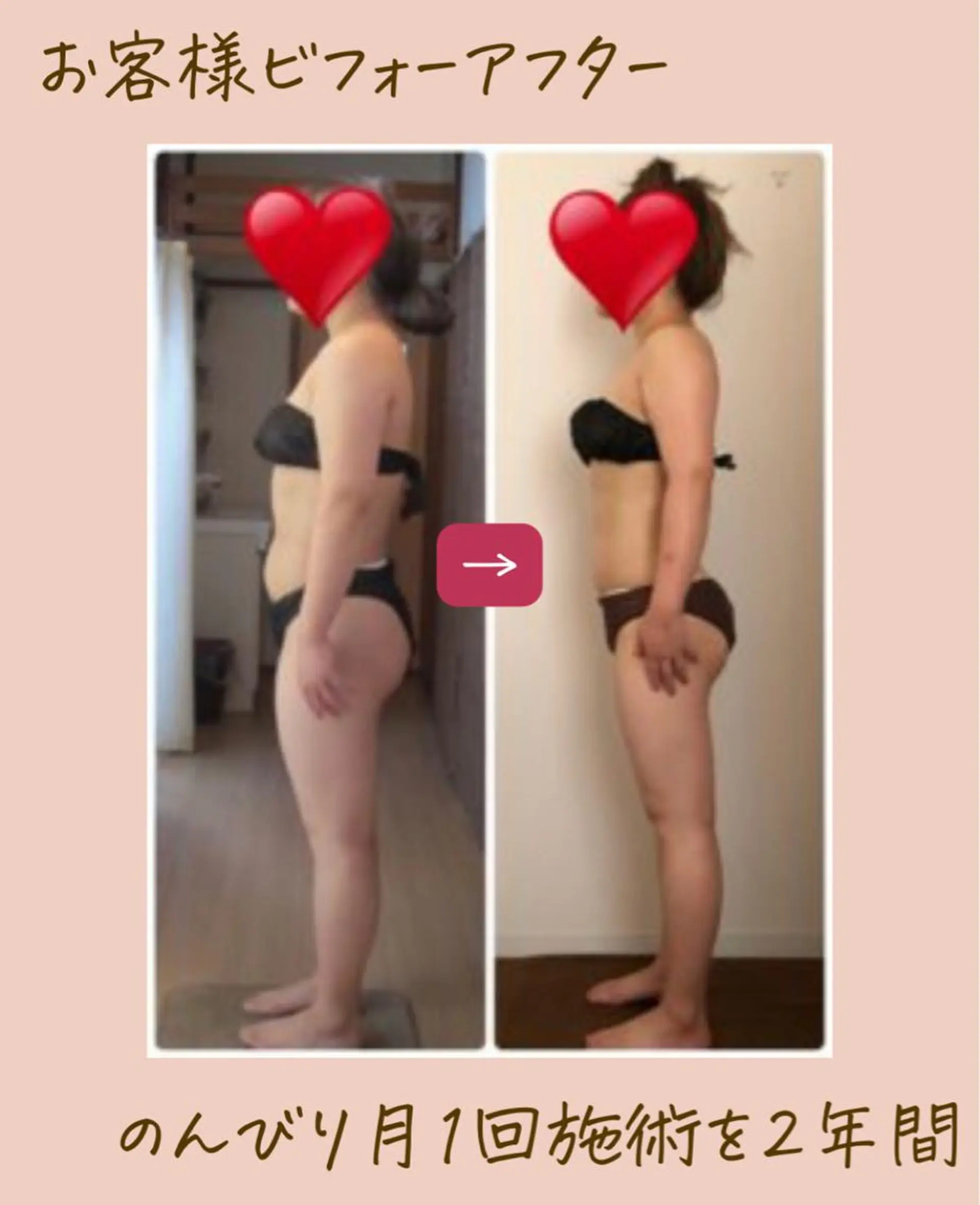 エステ リラク エステサロンNerice所属・トロふわ愛され 美ボディNericeのエステ・リラクイメージ