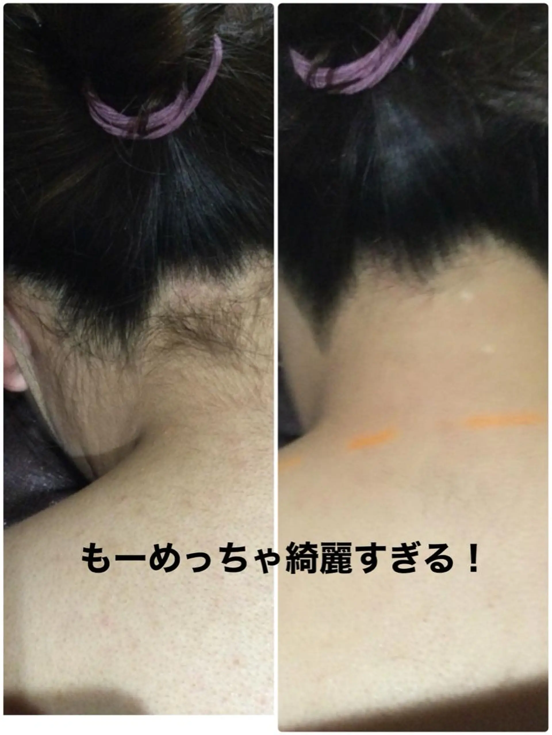 脱毛 Ange vivalavidaのエステ・リラクイメージ