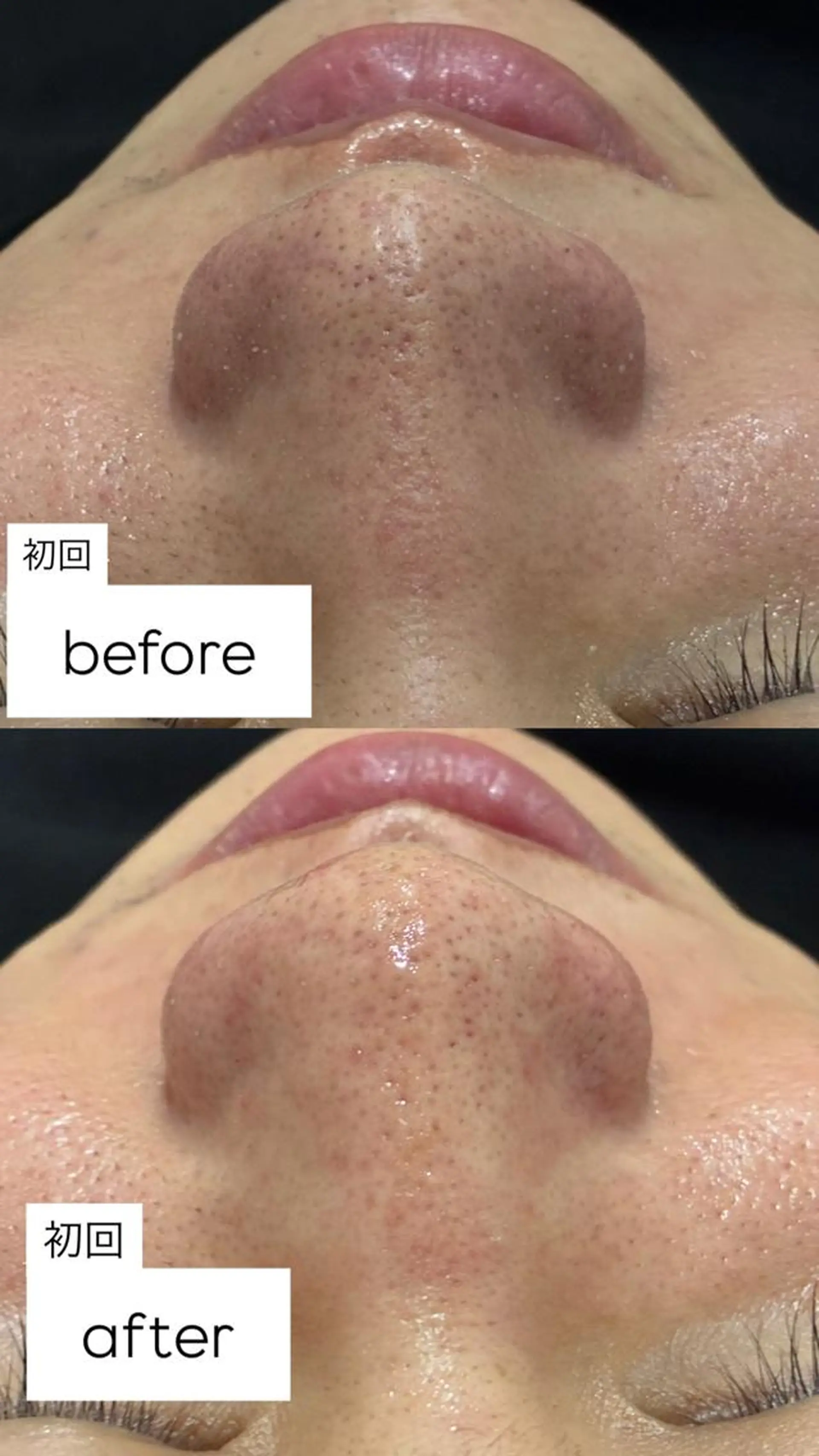 その他 毛穴シミケアサロン Beau　堀口まひろのその他イメージ