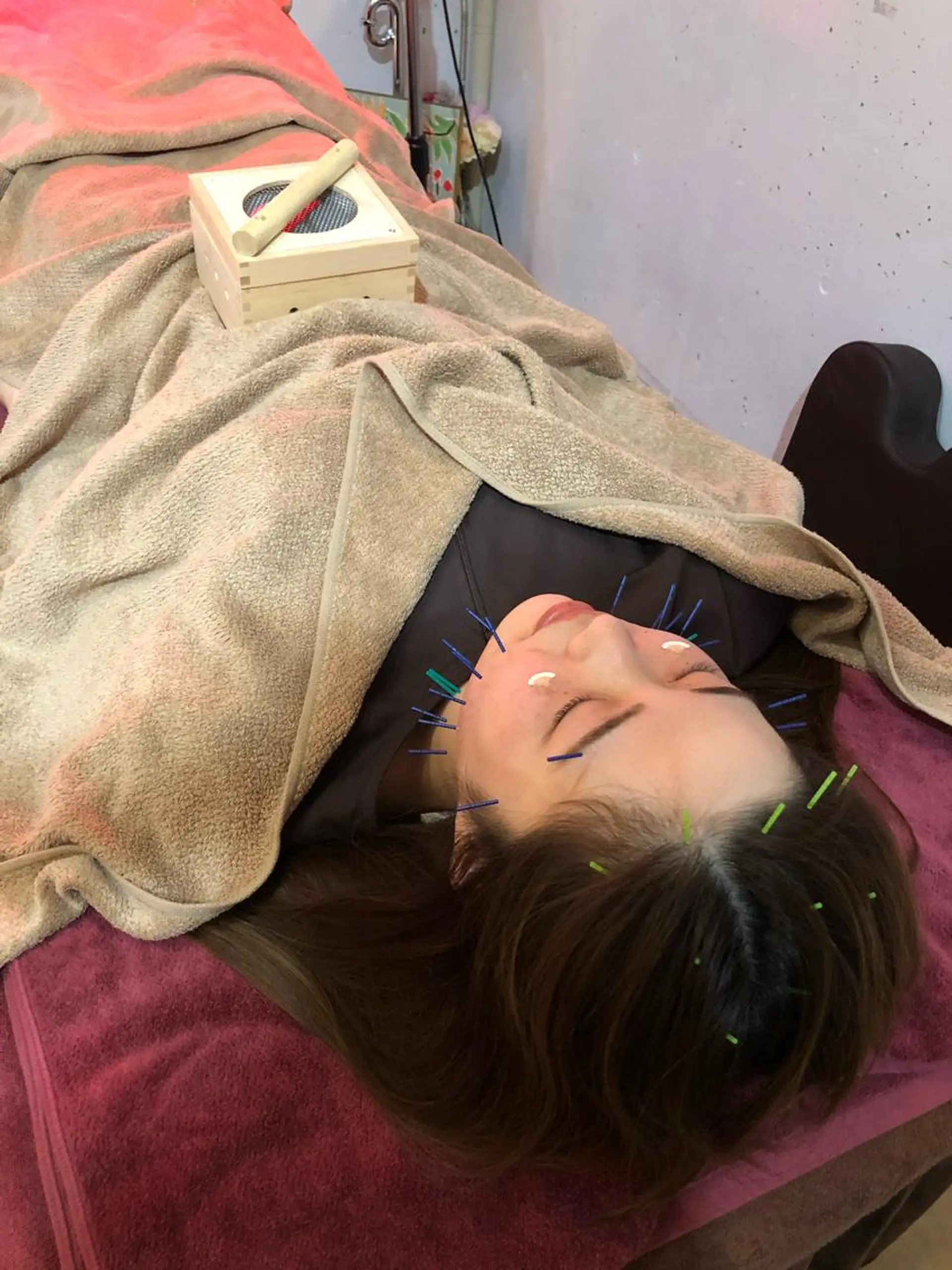 美容鍼灸女性専用 りんご鍼灸治療院のその他イメージ