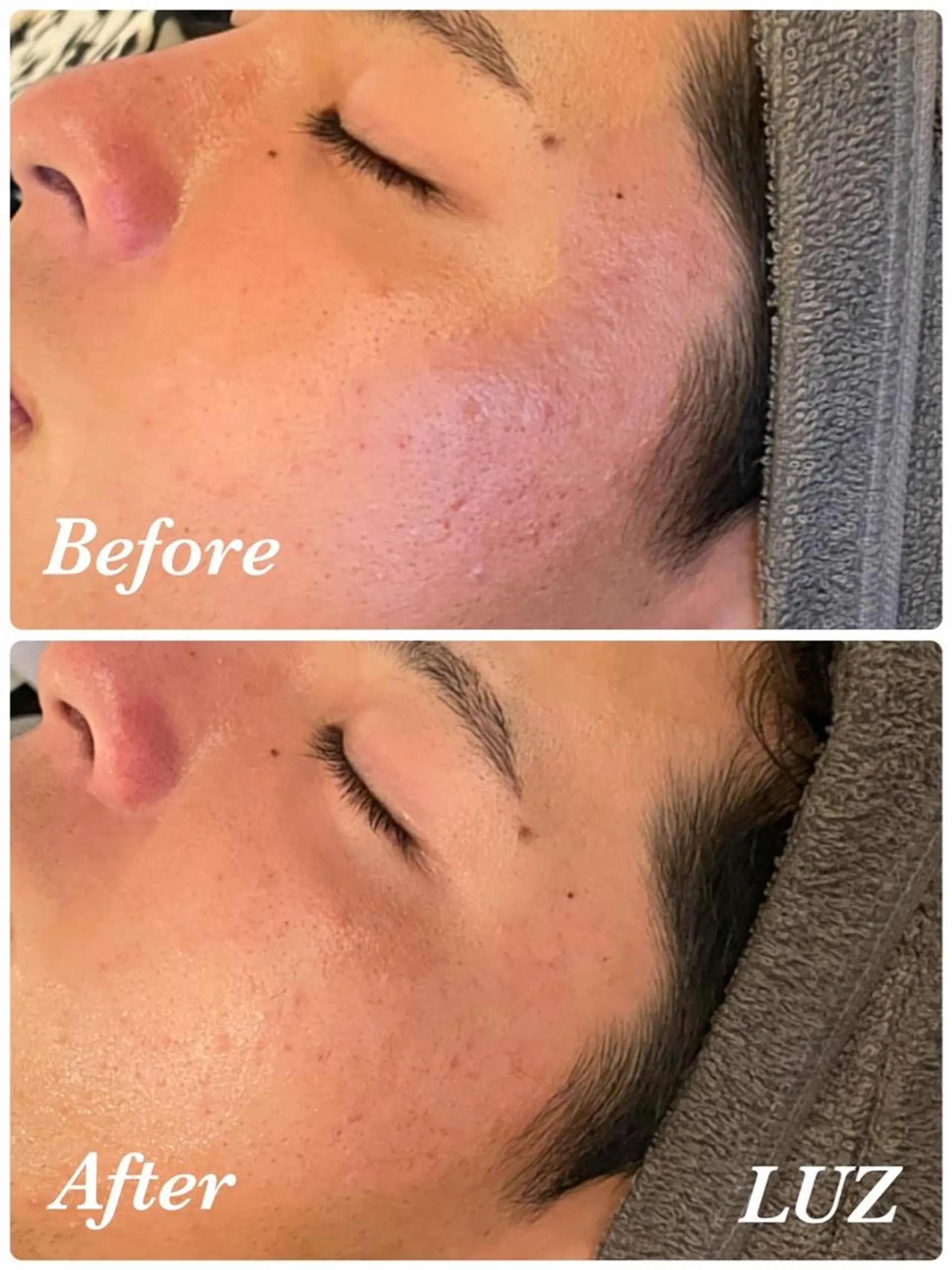 メンズ メンズフェイシャル アイブロウ・ルースのエステ・リラクイメージ