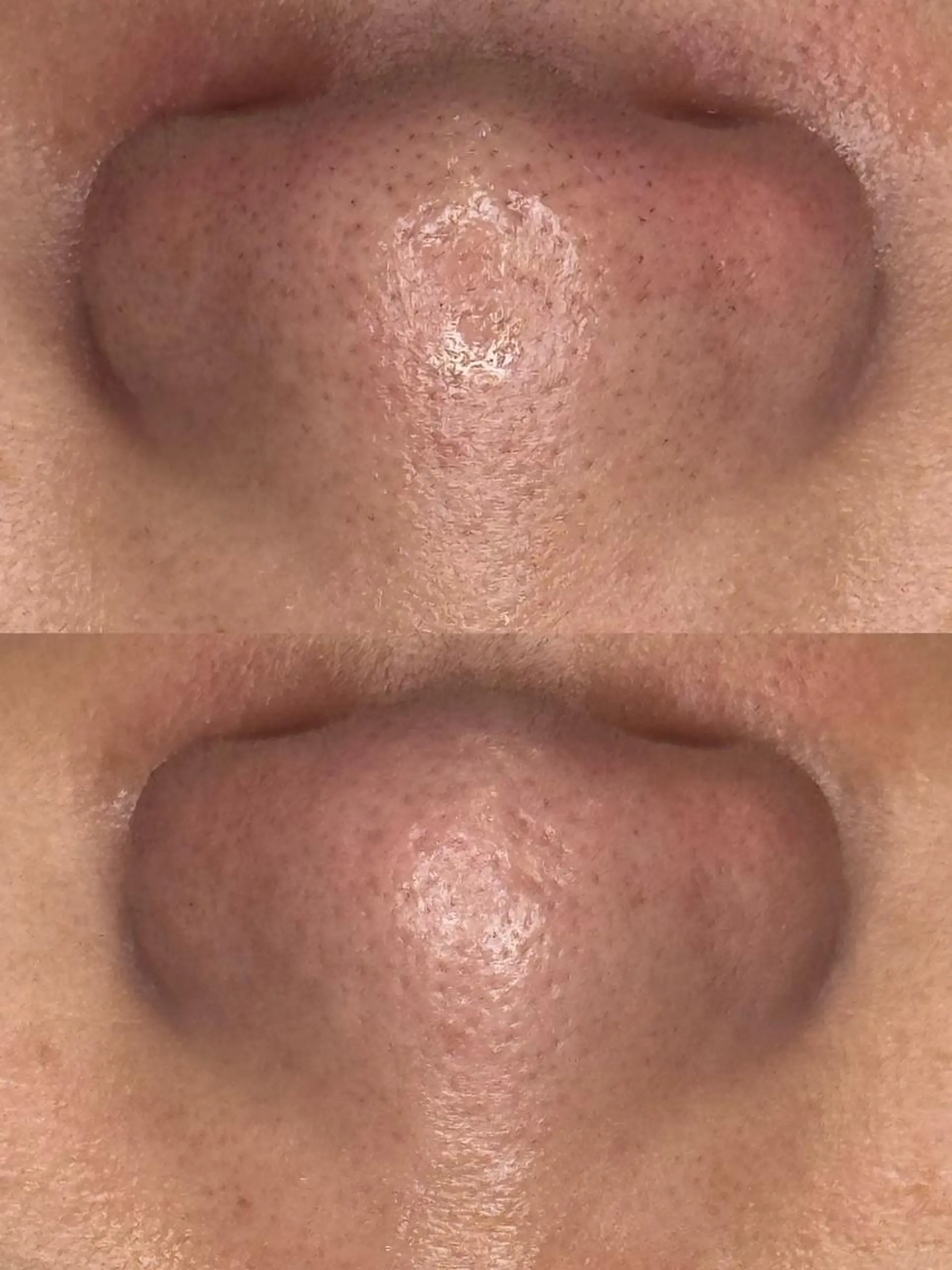 エステ NACHUL MANAのその他イメージ