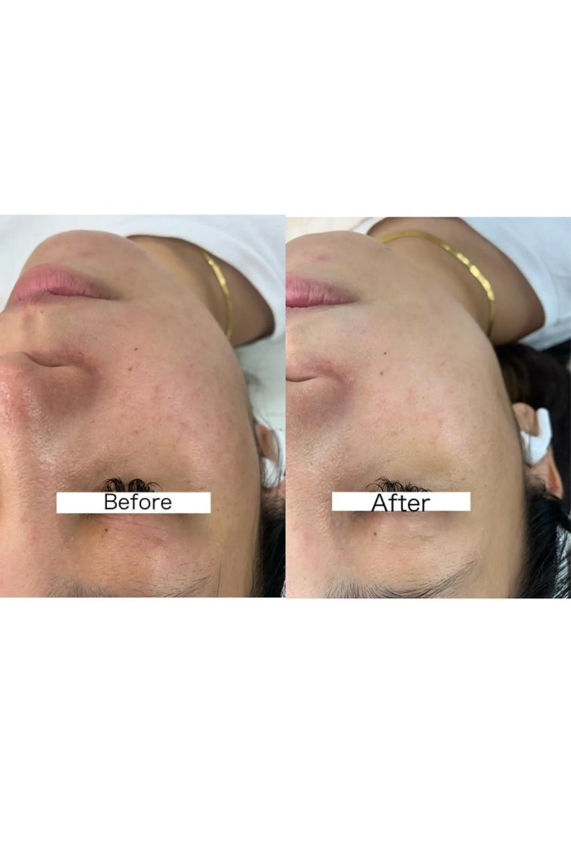 ナリスビューティサロンあべの所属・肌質改善/ツヤ肌作り /松本杏奈のエステ・リラクイメージ