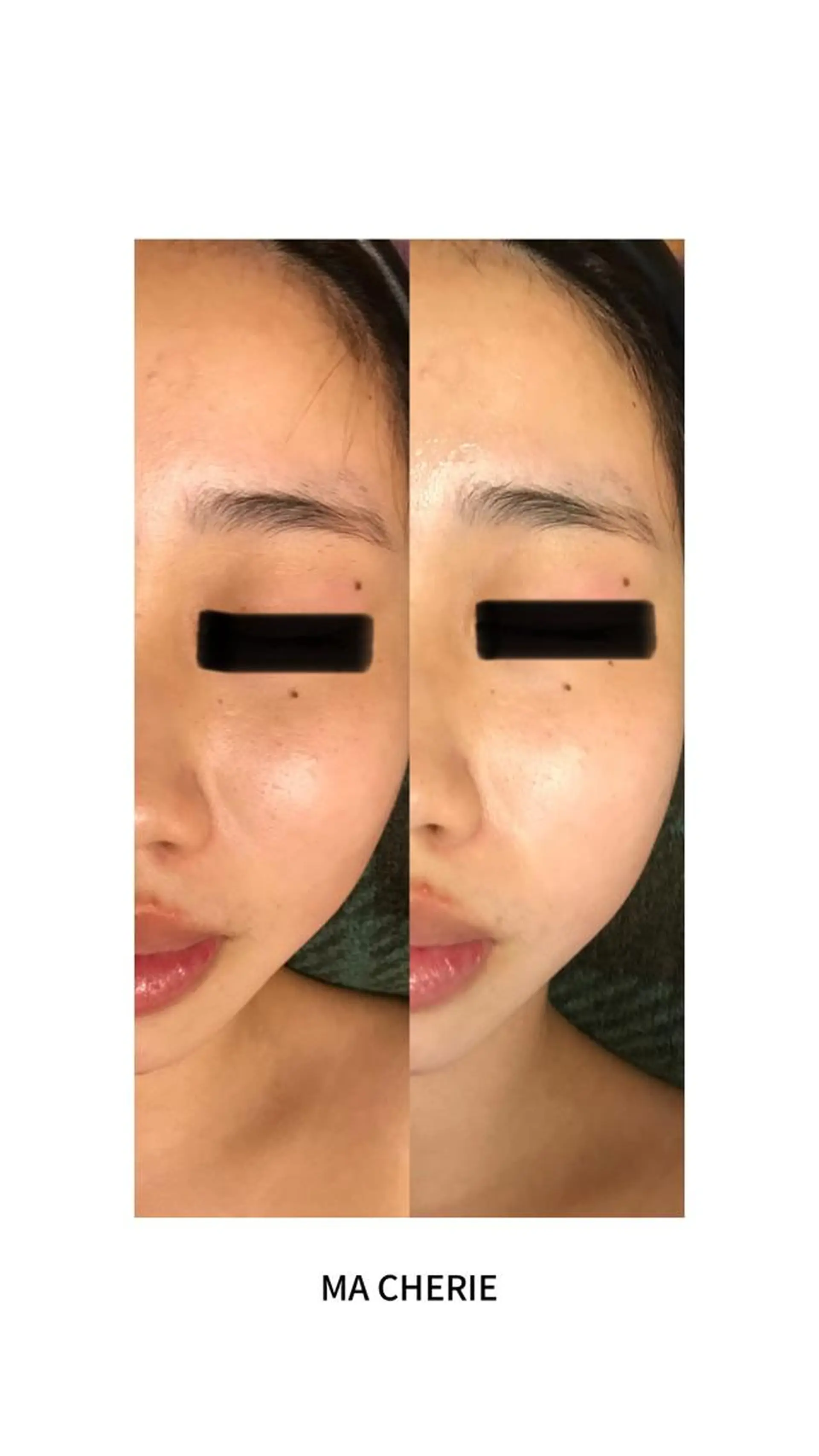 エステ 体質別痩身&小顔 MA CHÉRIEのエステ・リラクイメージ