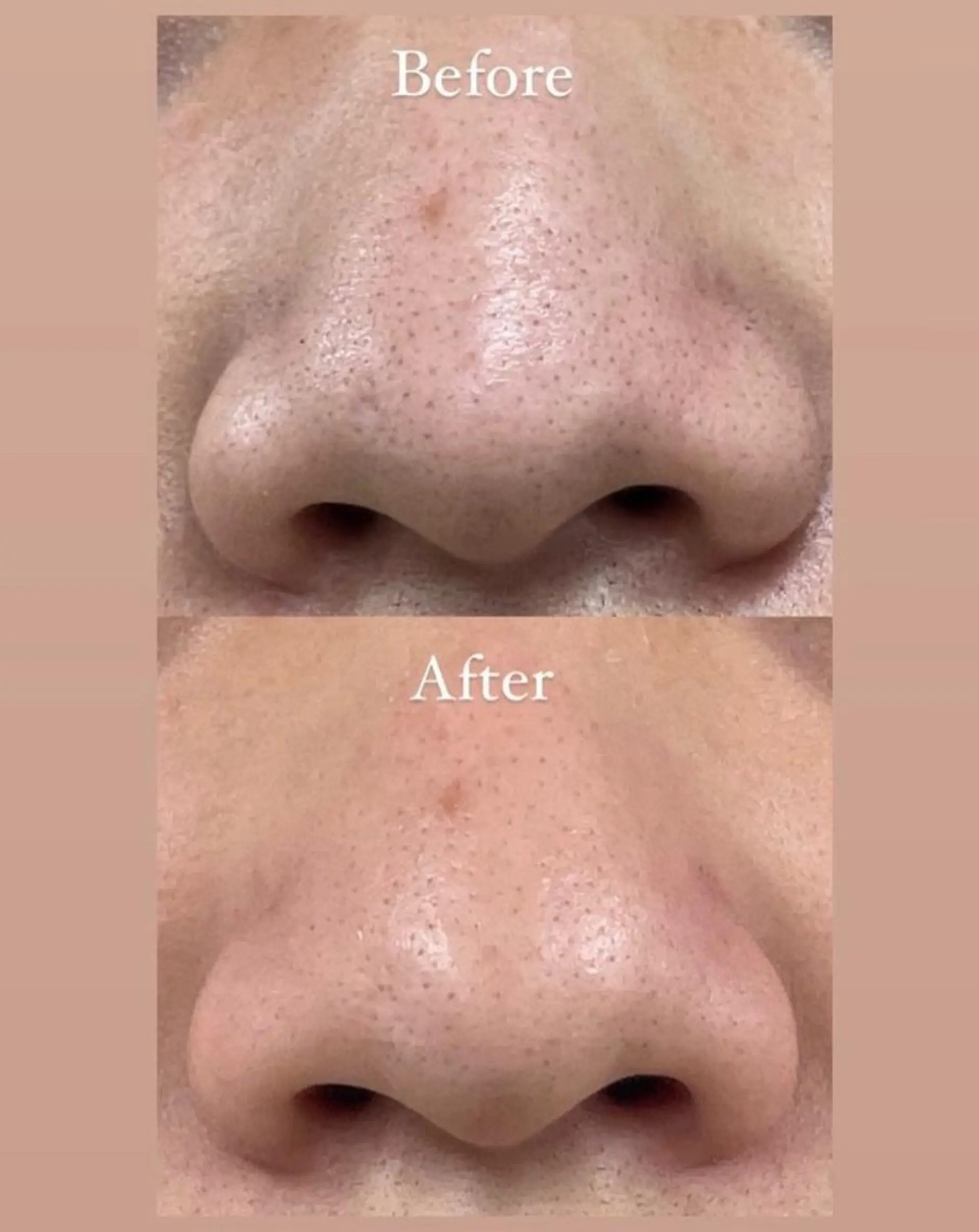 sharesalon PESCAのネイルデザイン