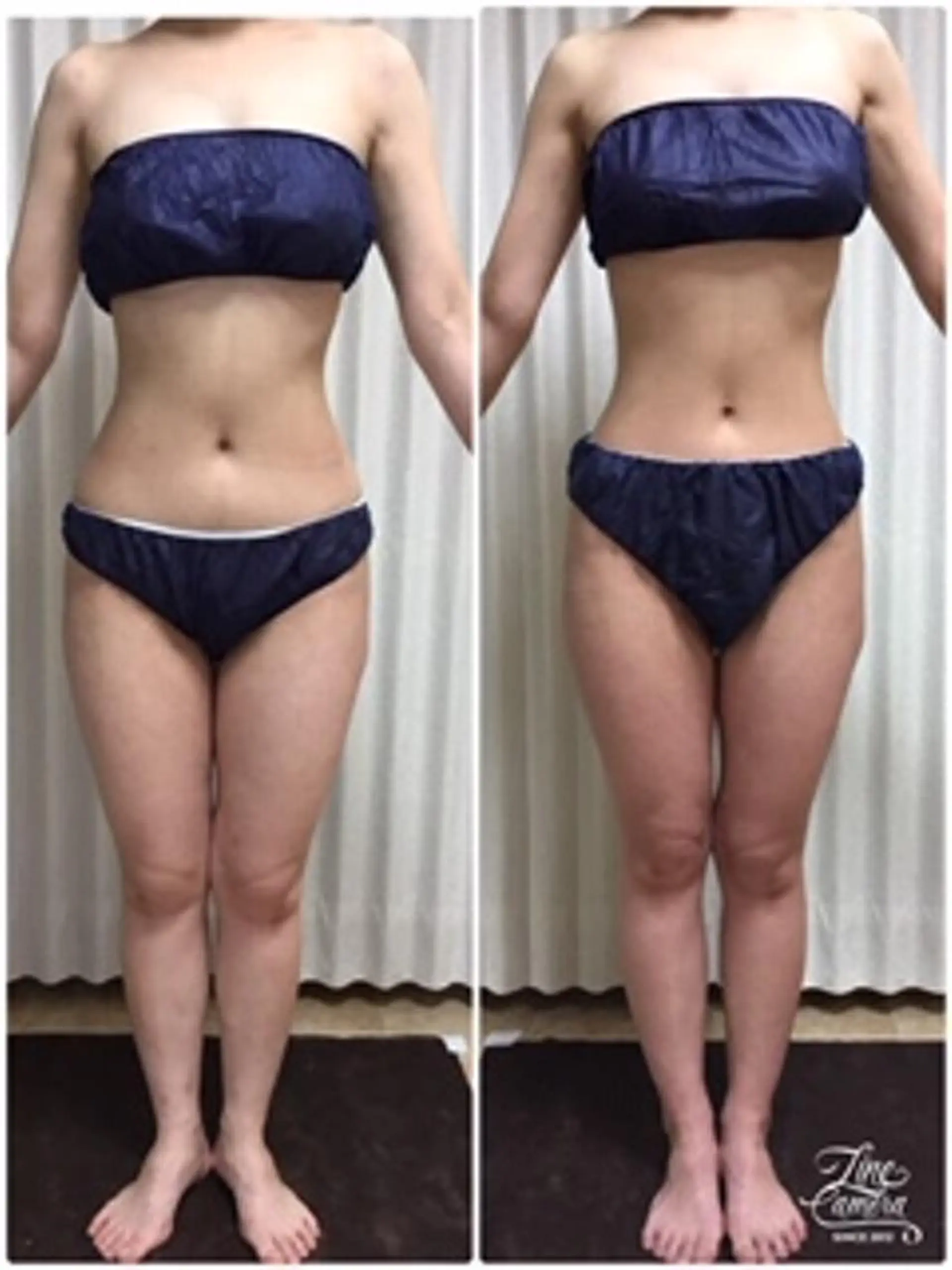 レイビス盛岡店 ♡吉田♡のエステ・リラクイメージ