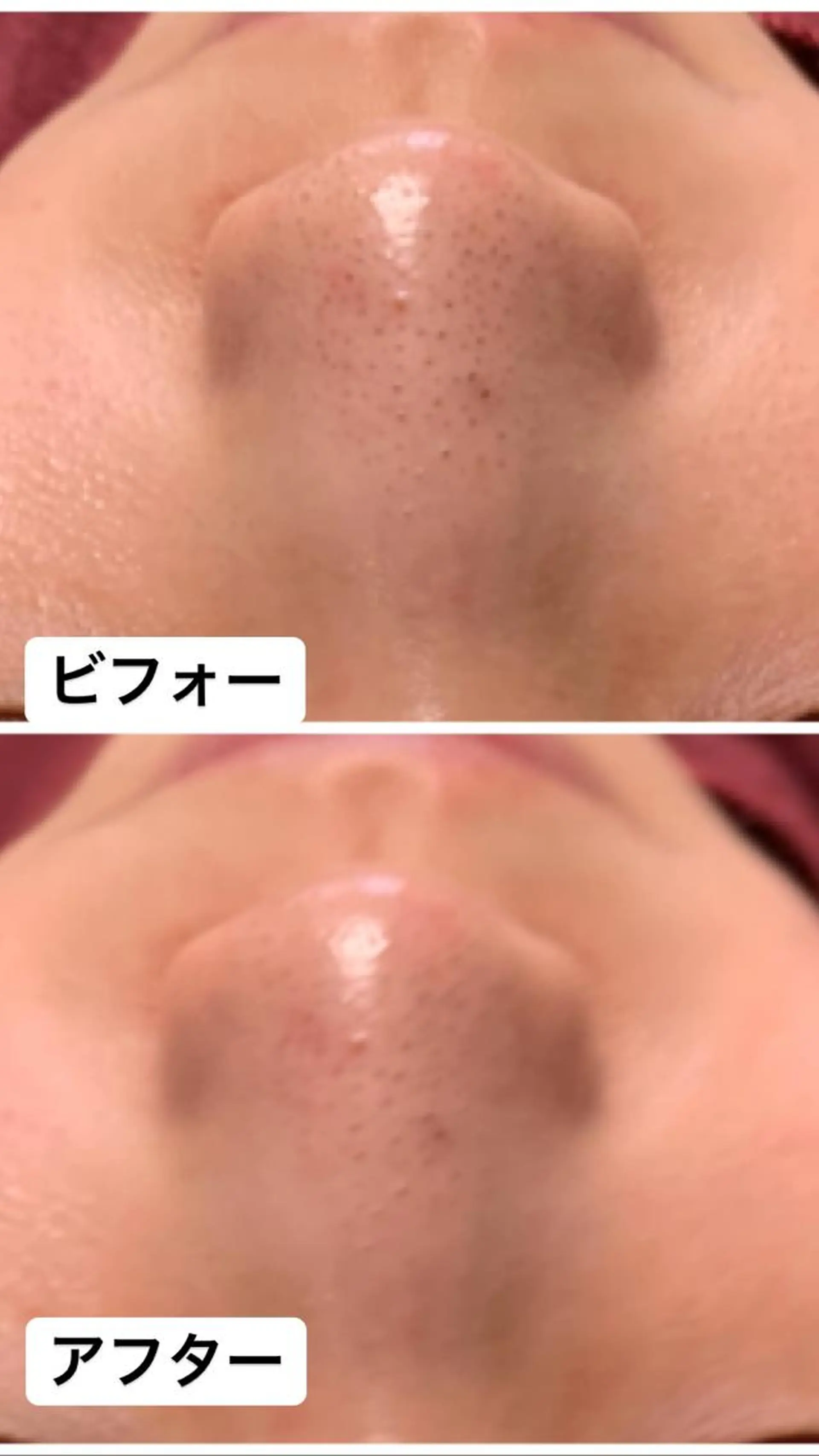 Lien オーナー　山口智嘉のエステ・リラクイメージ