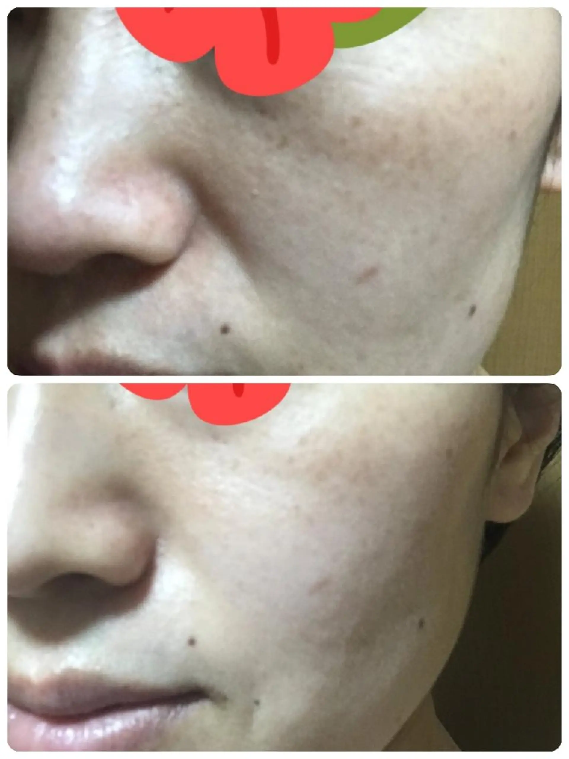 ユテラ 佑來（ゆき）のエステ・リラクイメージ