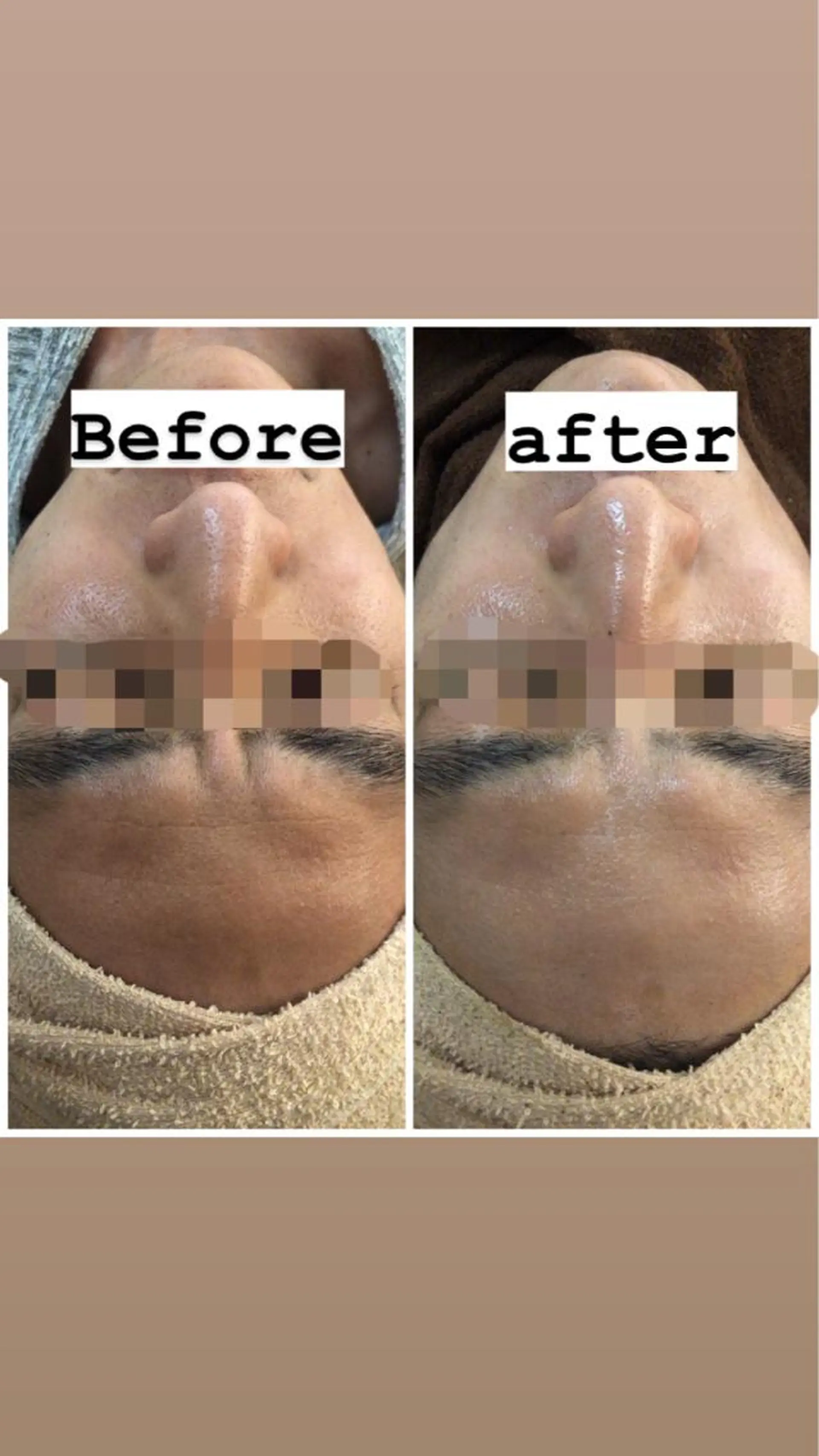 ショート カラー パーマ ヘアアレンジ メンズ キッズ ネイル マツエク・マツパ アイブロウ Amaryllis 🌹のエステ・リラクイメージ