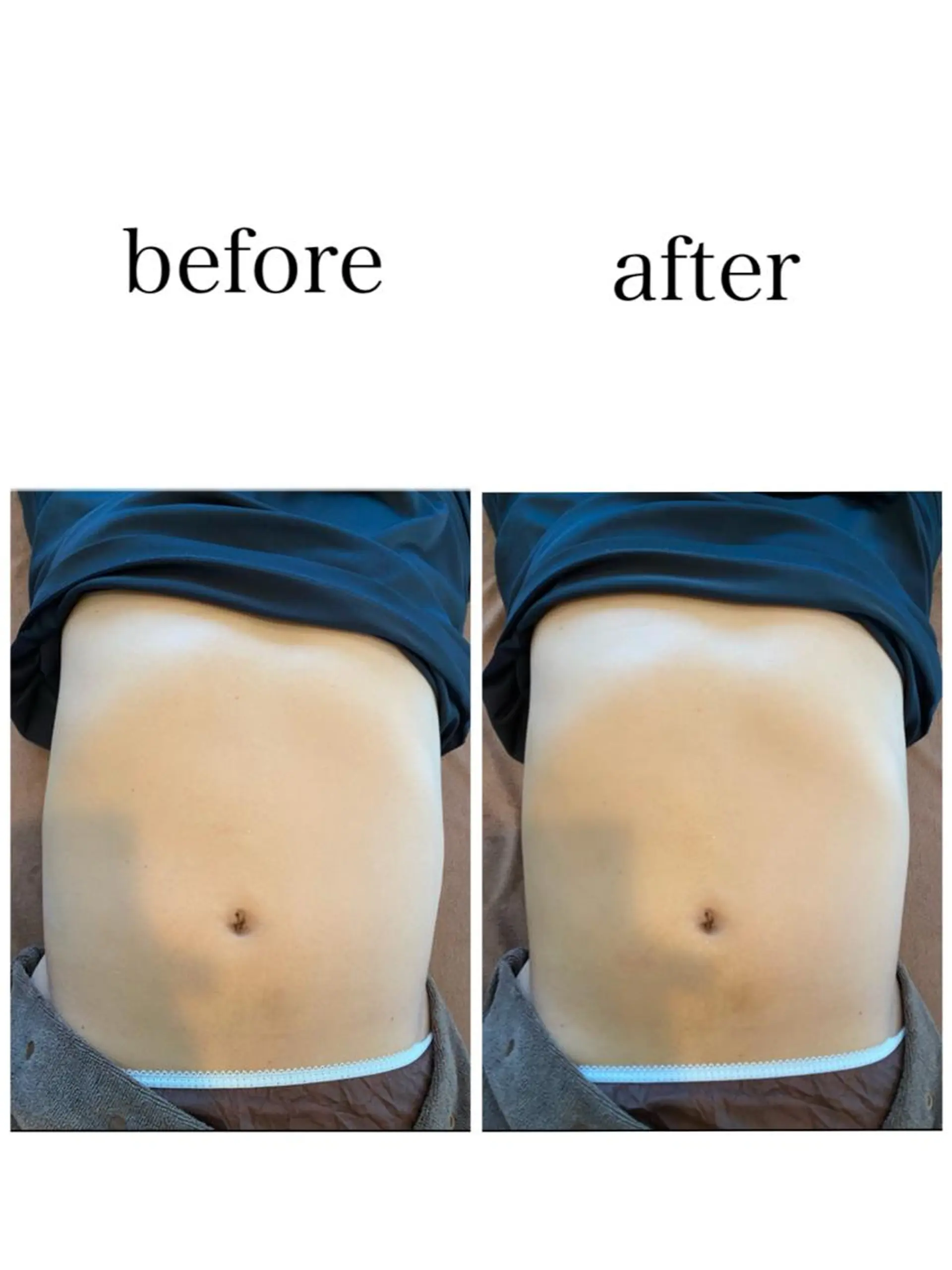 姿勢改善 サロンLAUB奥村のエステ・リラクイメージ