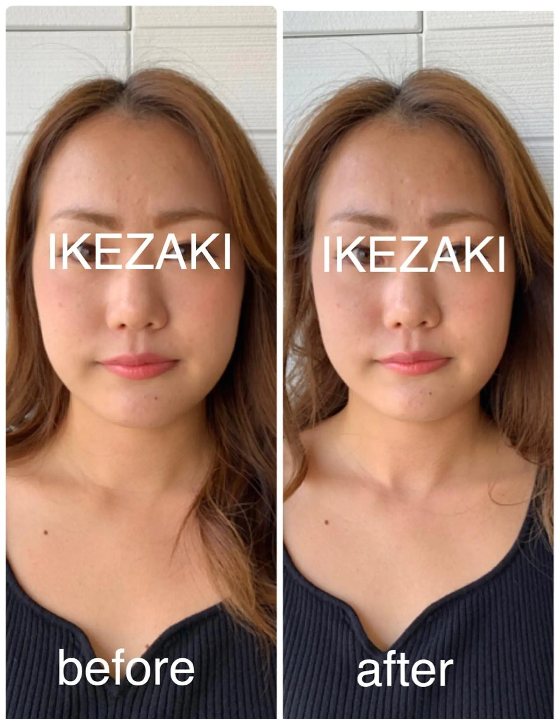 美容鍼 IKEZAKIのエステ・リラクイメージ