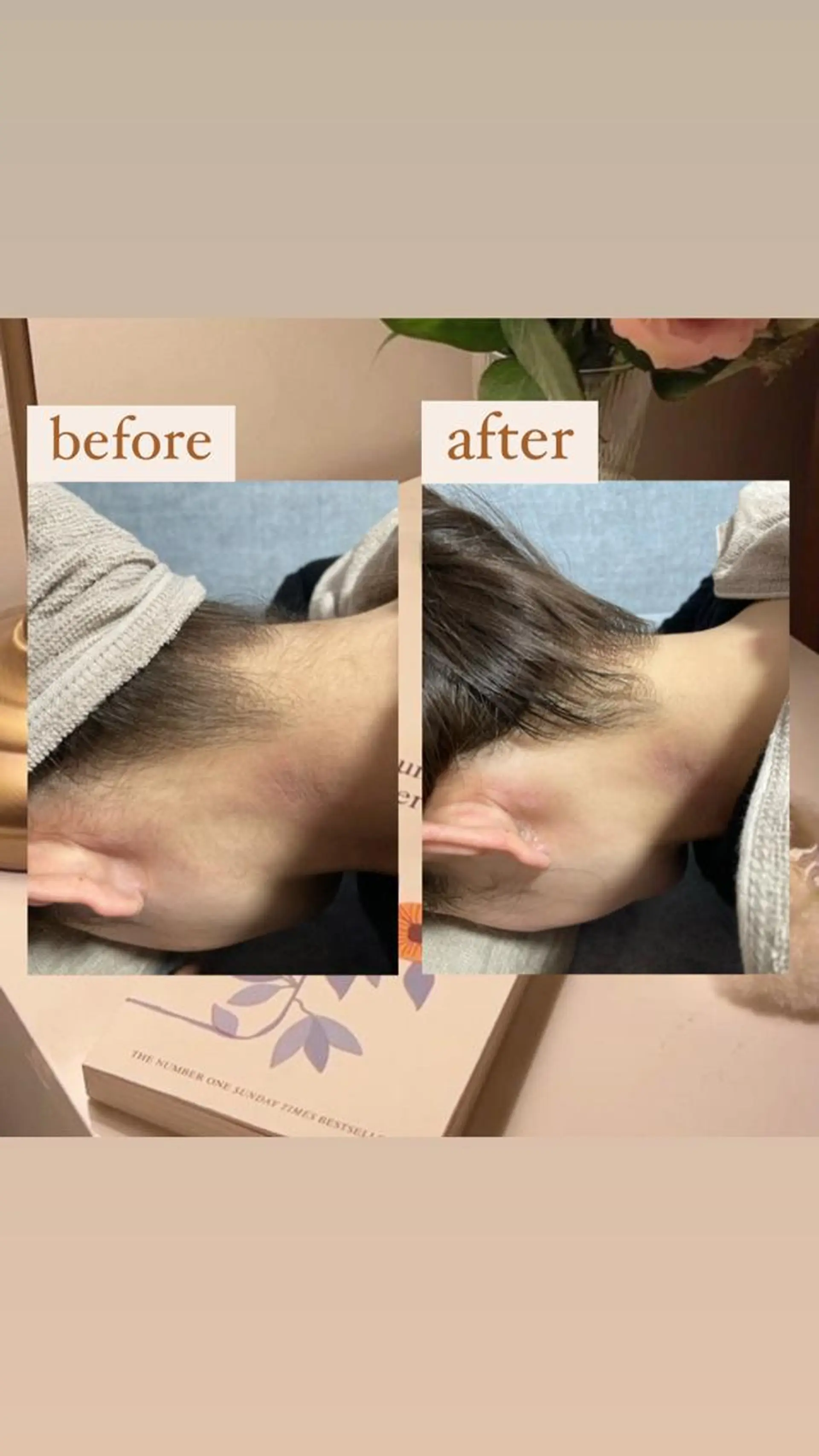 脱毛 【韓国肌管理・脱毛】 クレセントのその他イメージ