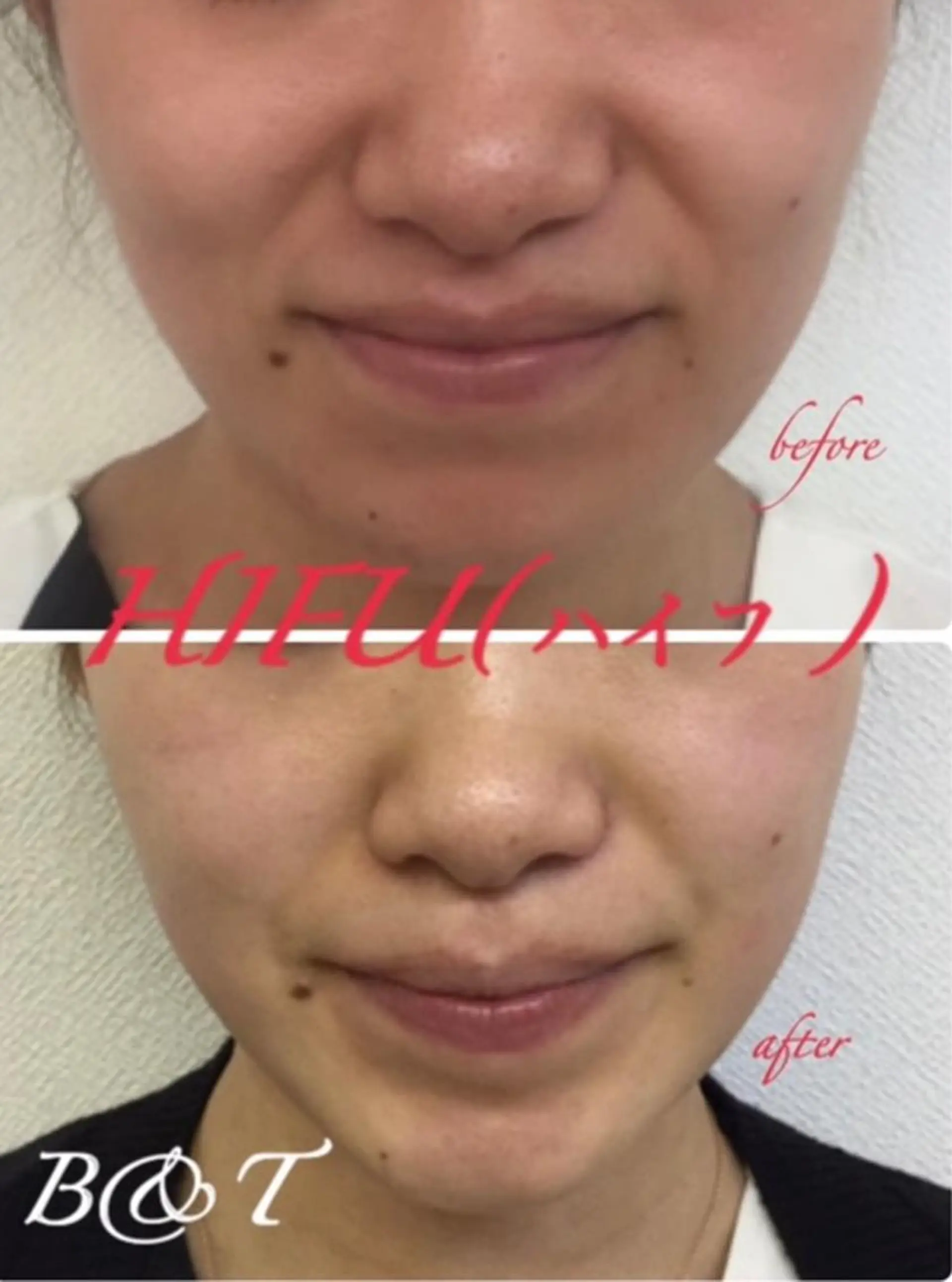 肌質改善サロン chouchouのエステ・リラクイメージ