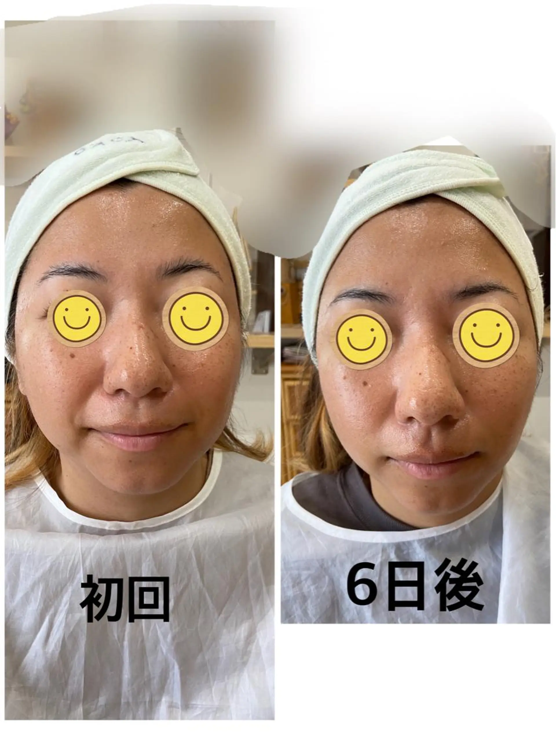 野崎 洋子のエステ・リラクイメージ