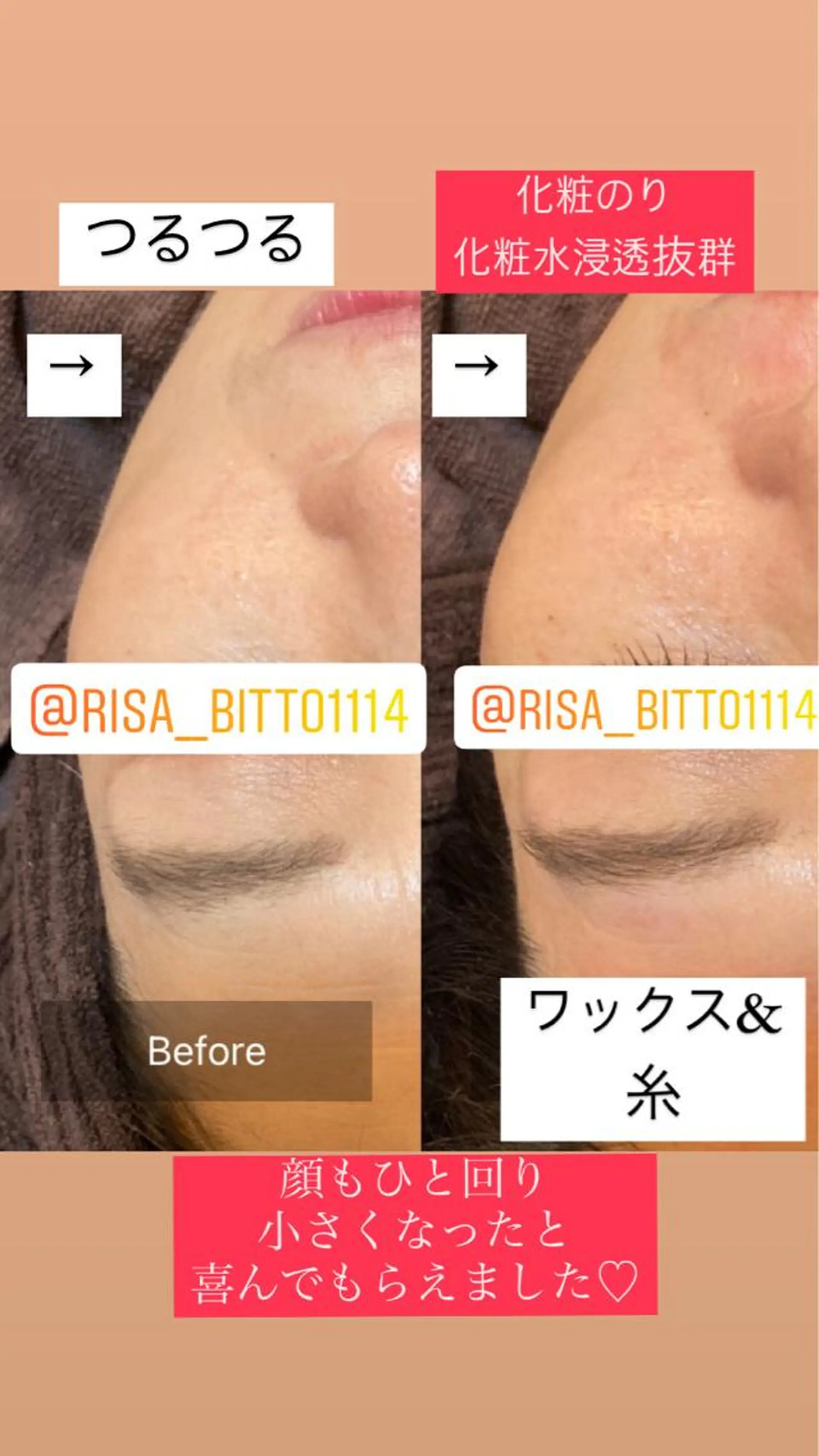 エステ 産毛専門店 Bittoのエステ・リラクイメージ