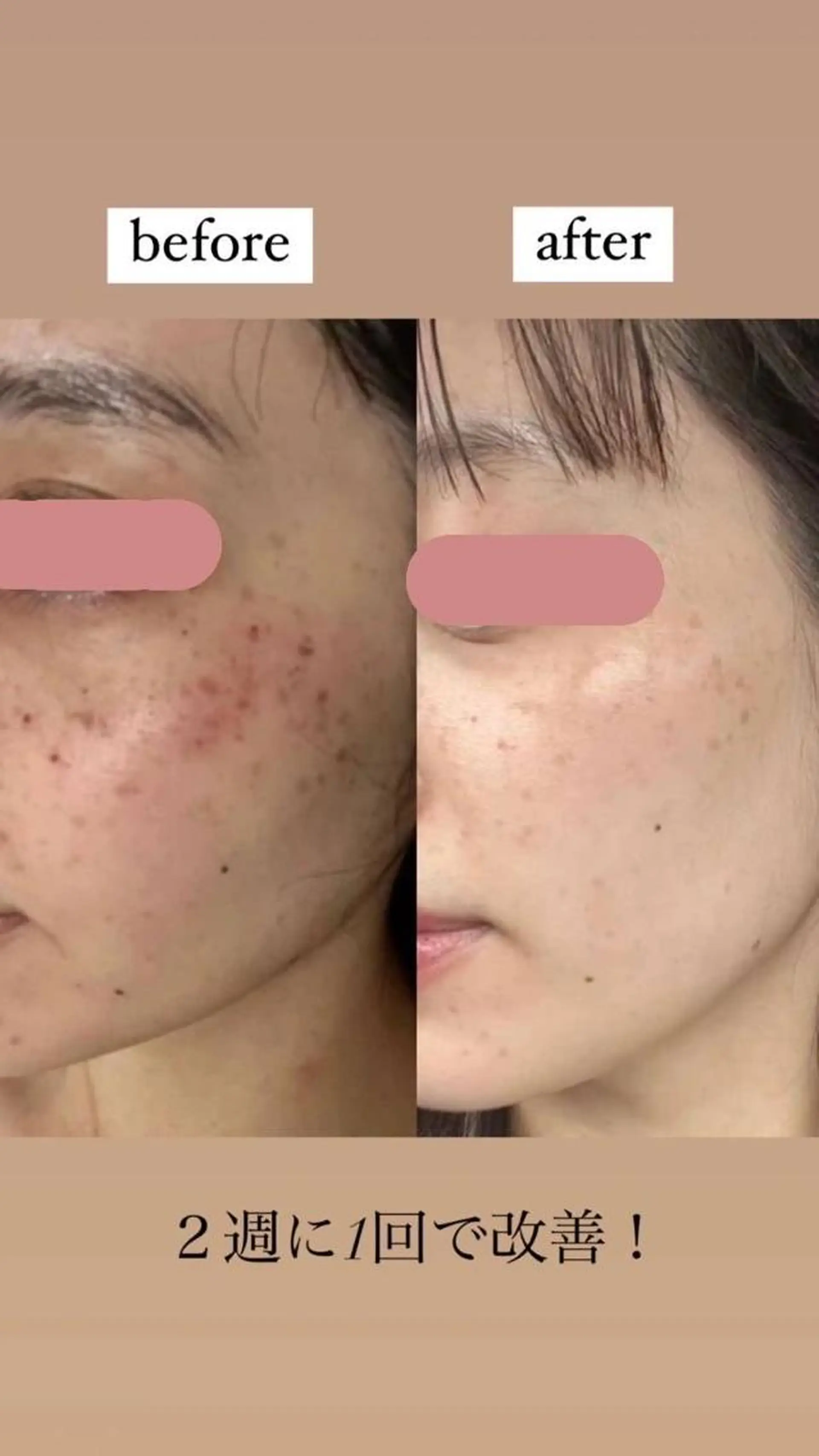 km retreat mentのエステ・リラクイメージ