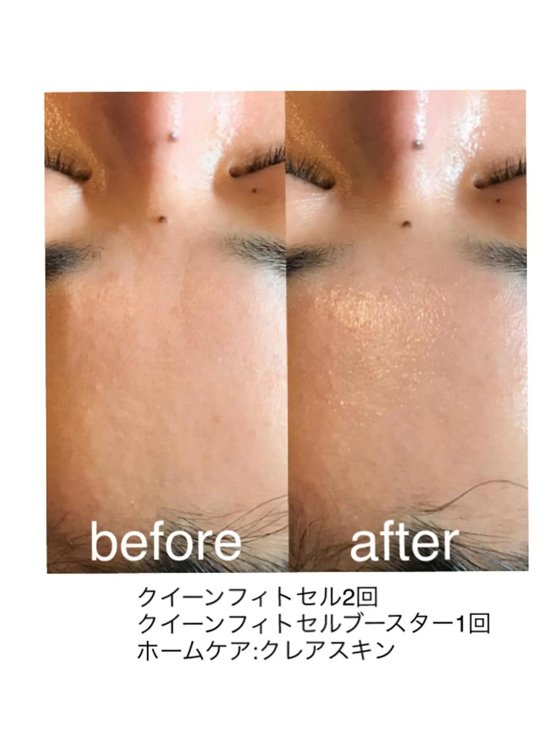 エステ 浜野 恵美のエステ・リラクイメージ