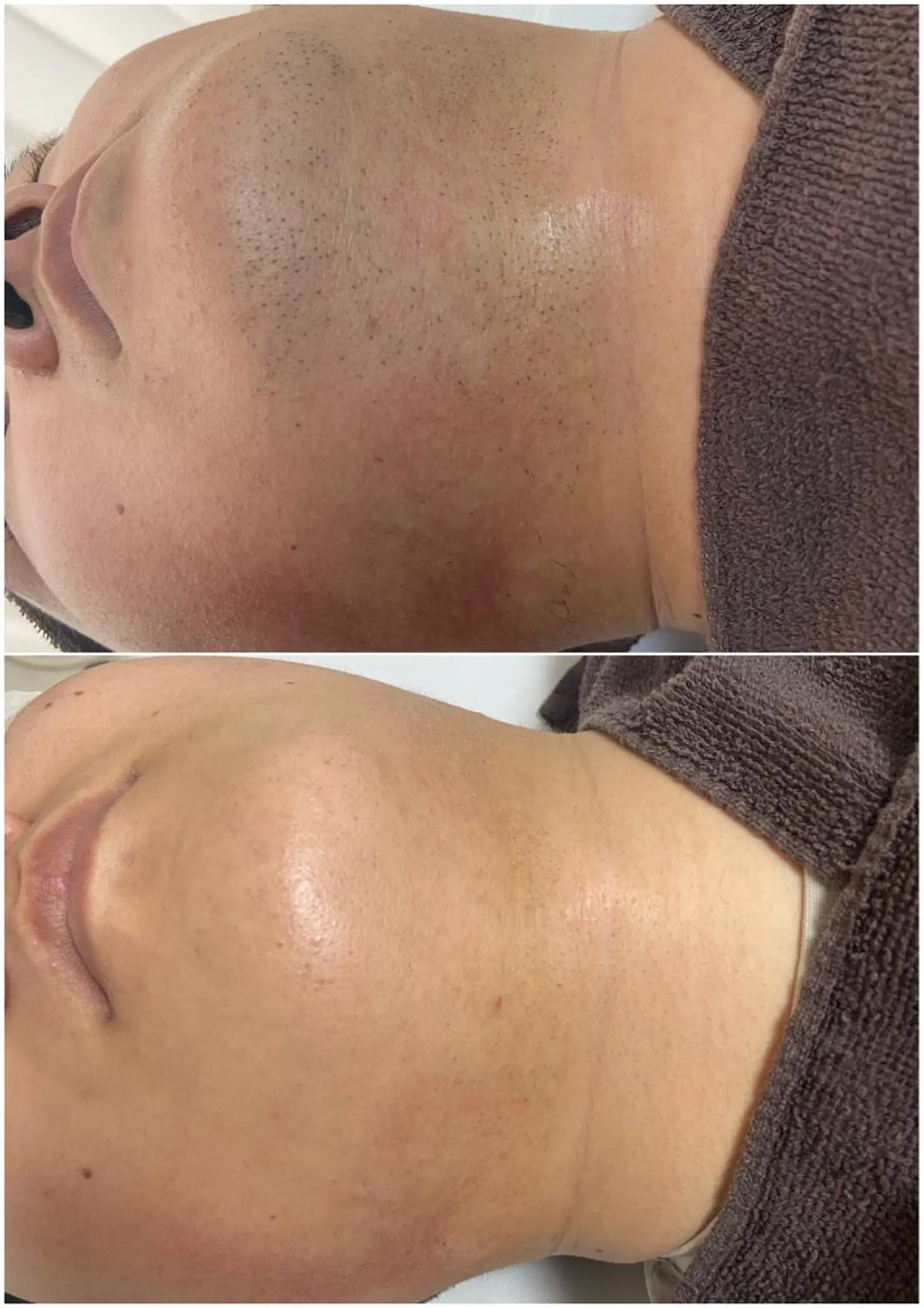 メンズ 都度払い制脱毛サロンBe Charm所属・Be Charm 山﨑のエステ・リラクイメージ