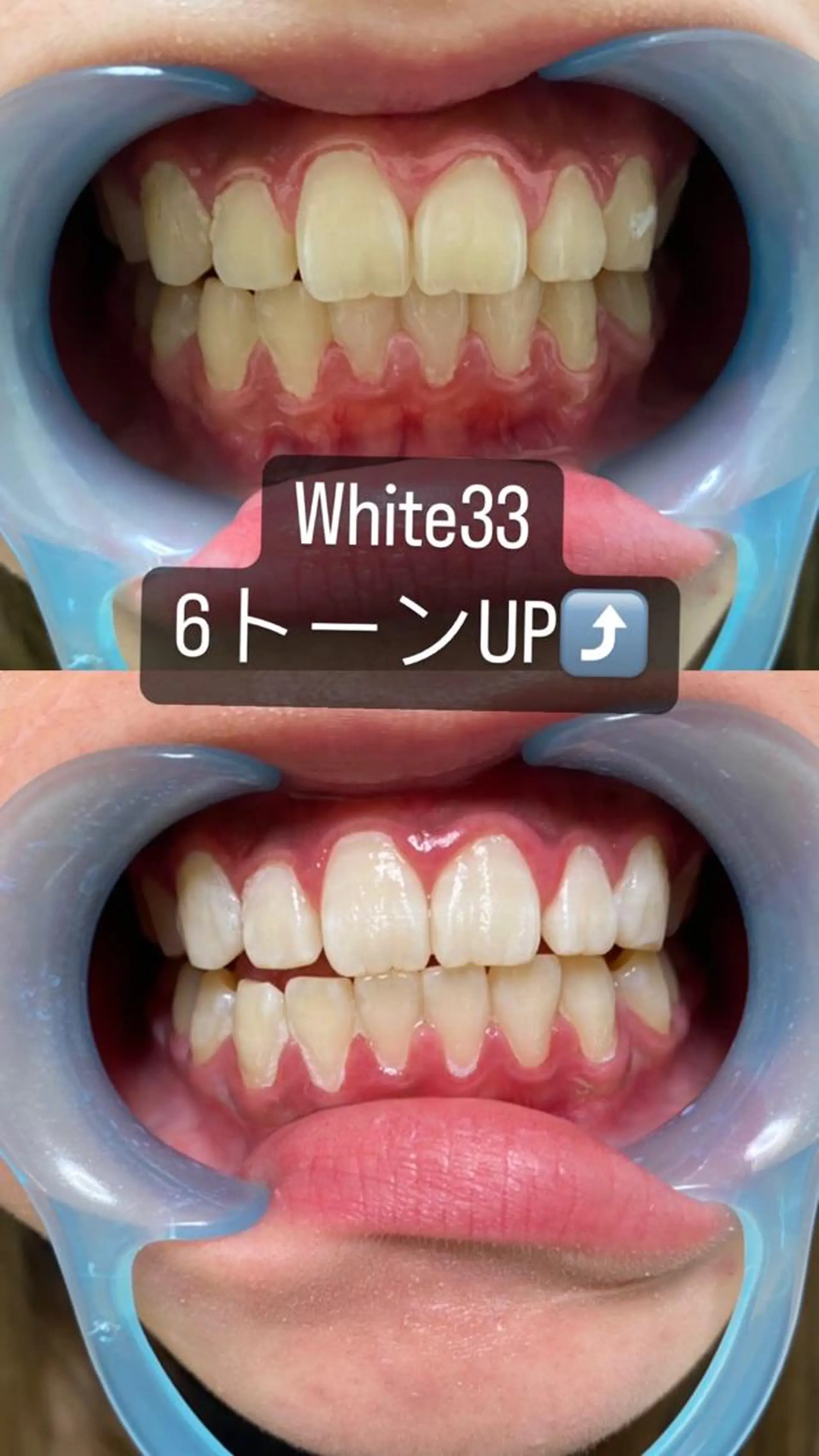 アイブロウ セルフホワイトニング White33大名のその他イメージ