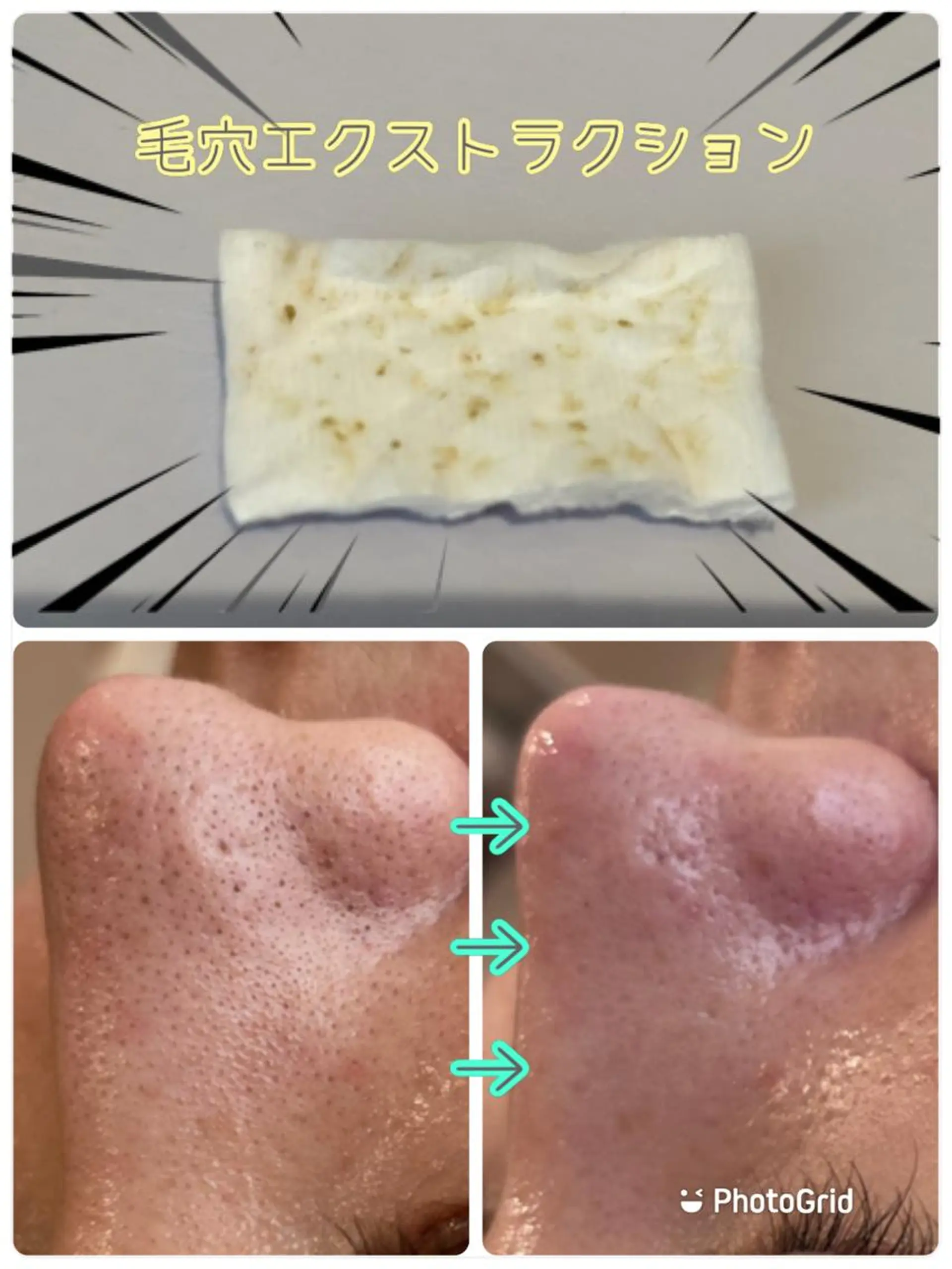 エステ 【リベルハーブピーリング認定店】敏感肌・美白脱毛専門店Dione立川店所属・Dione 立川店のエステ・リラクイメージ