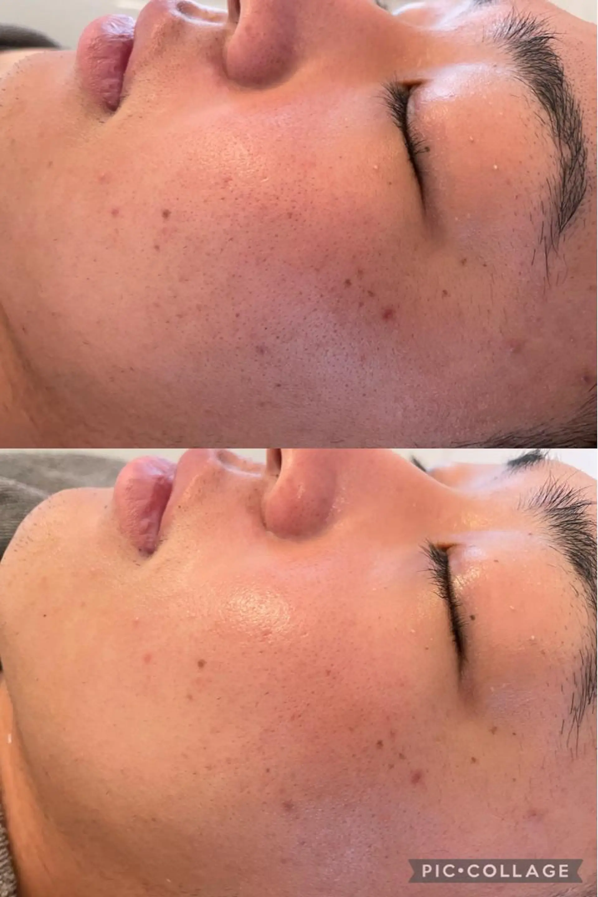 エステ Lavi&所属・肌質改善サロン Lavi&のその他イメージ