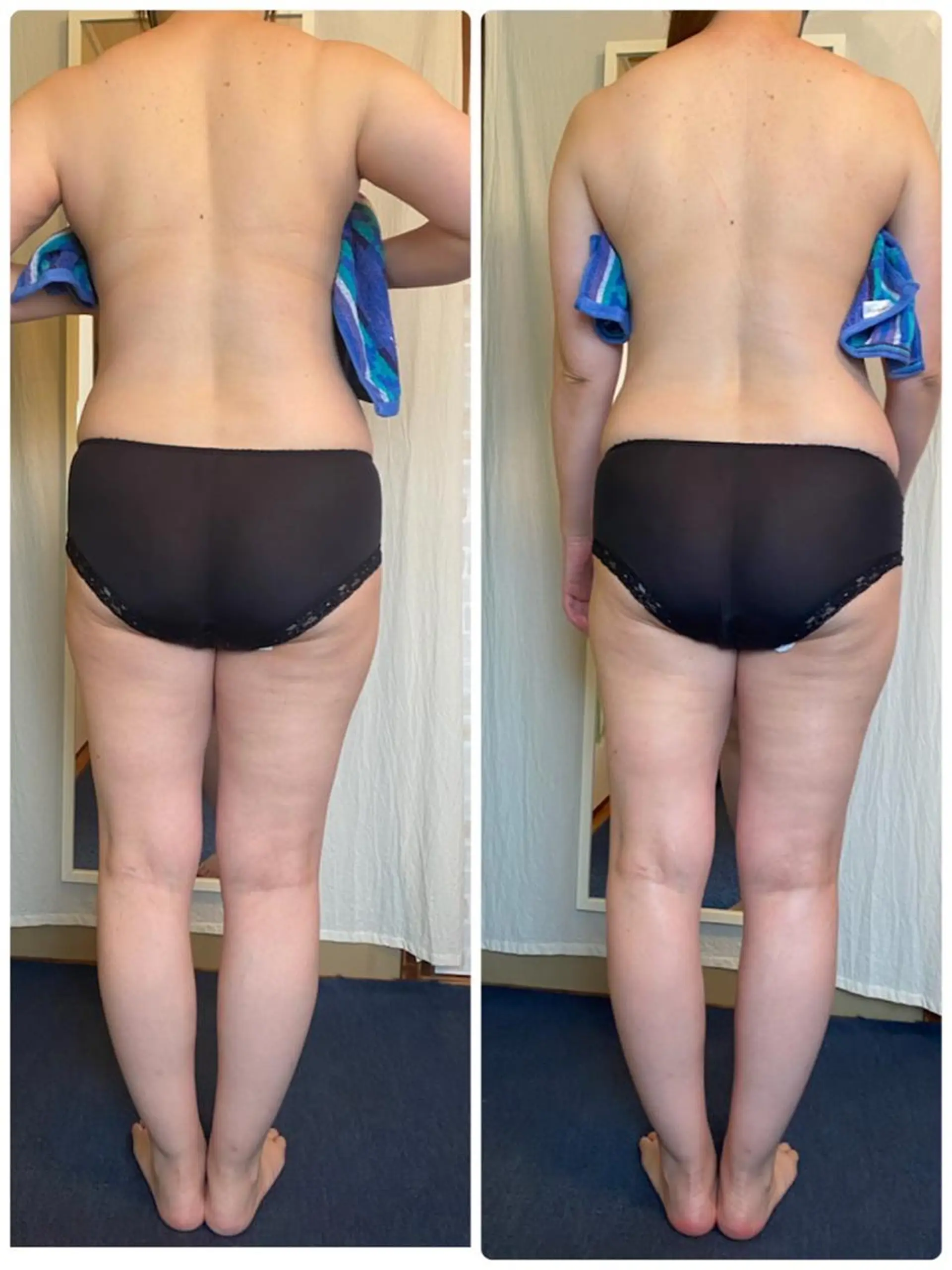 ロング ミリ ミリのエステ・リラクイメージ