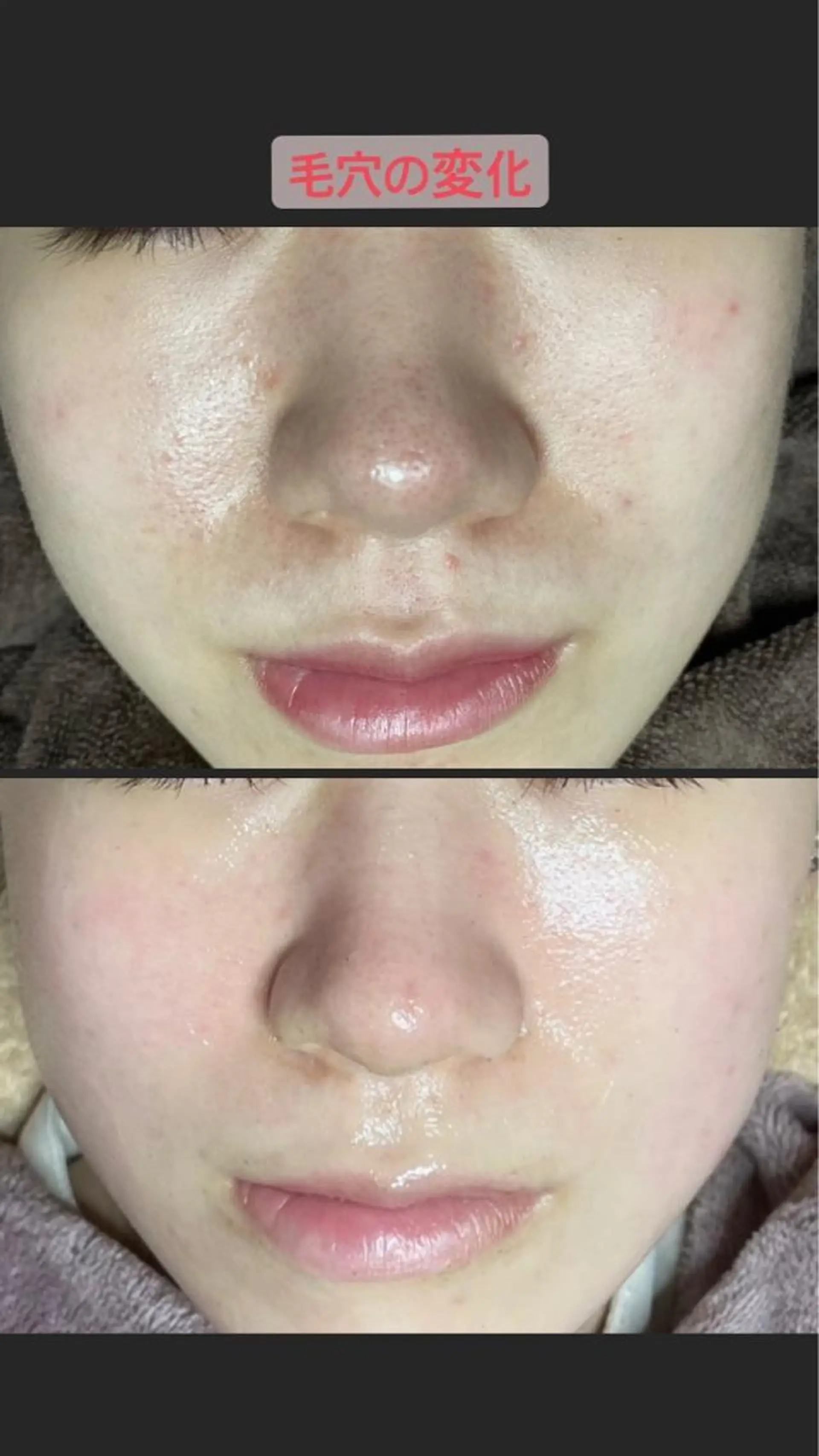 代表 MOMOのエステ・リラクイメージ