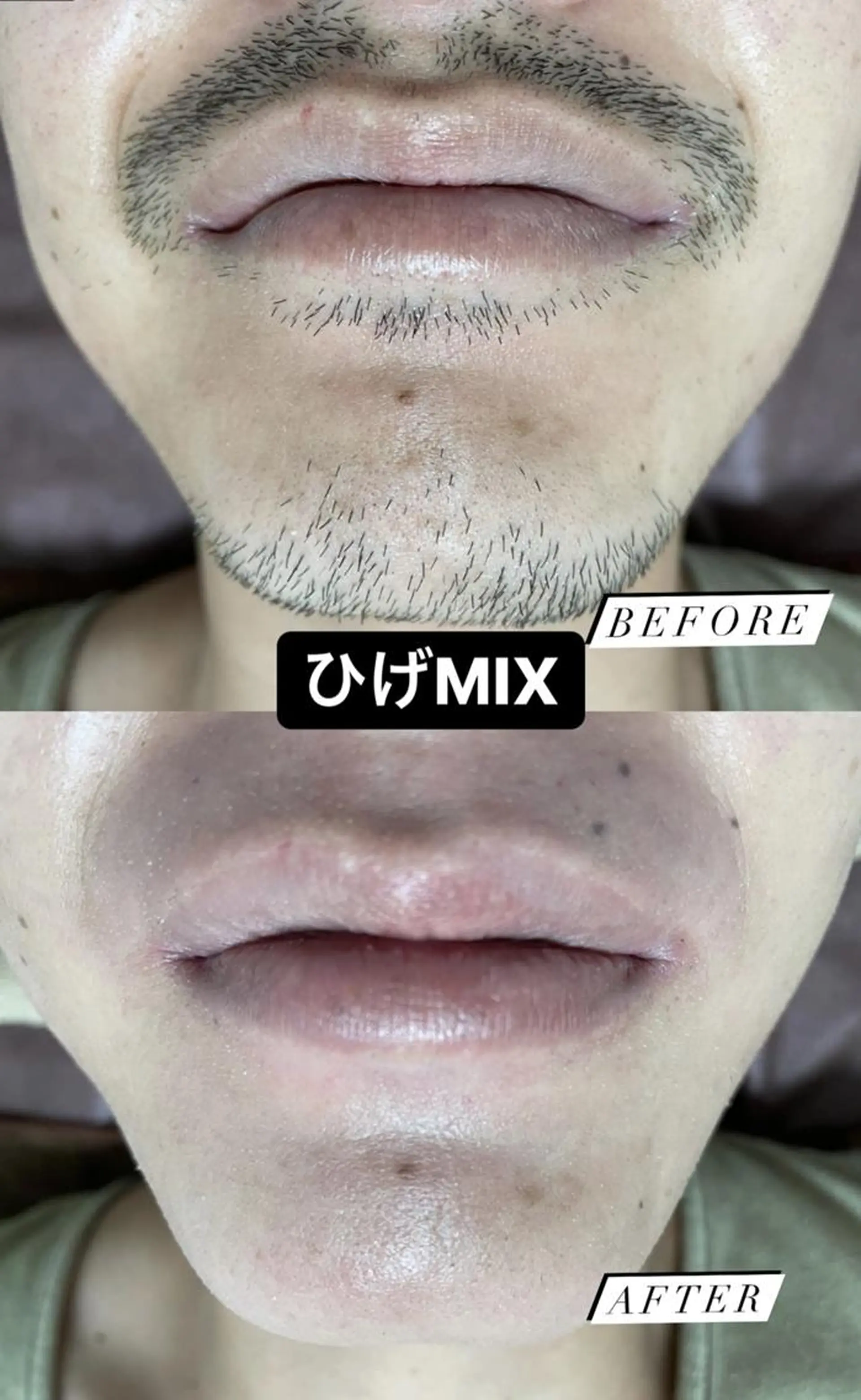 メンズ キッズ 脱毛 Epina 千葉店 【エピナ】のエステ・リラクイメージ