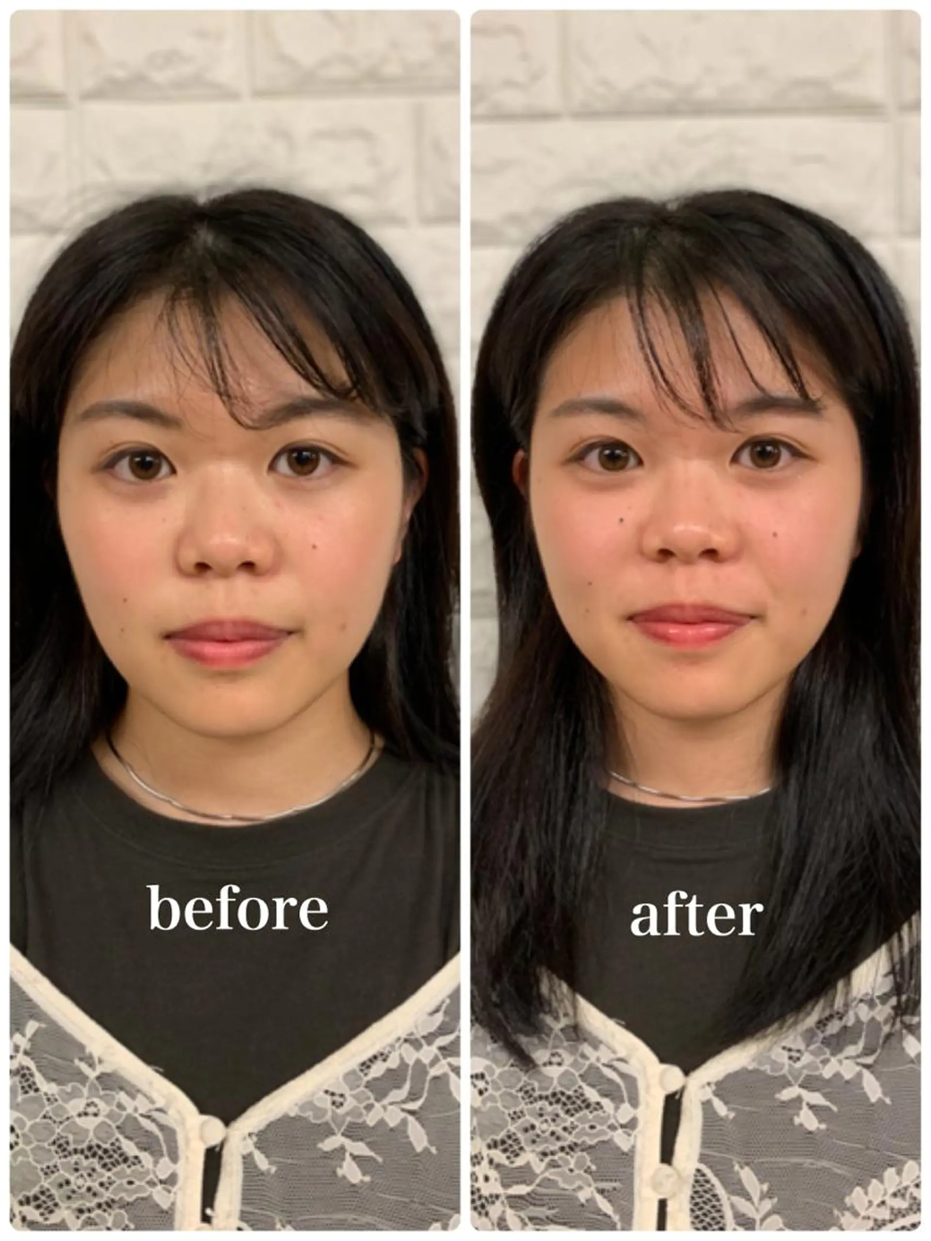 美容鍼 IKEZAKIのエステ・リラクイメージ