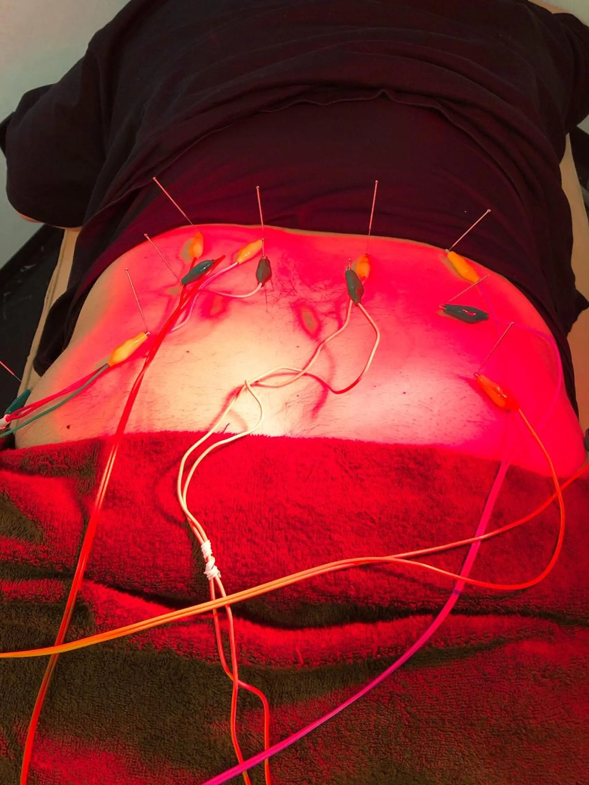 その他 美容鍼灸整体サロンBeauJu所属・小顔矯/美容鍼/鍼灸 BeauJuのその他イメージ