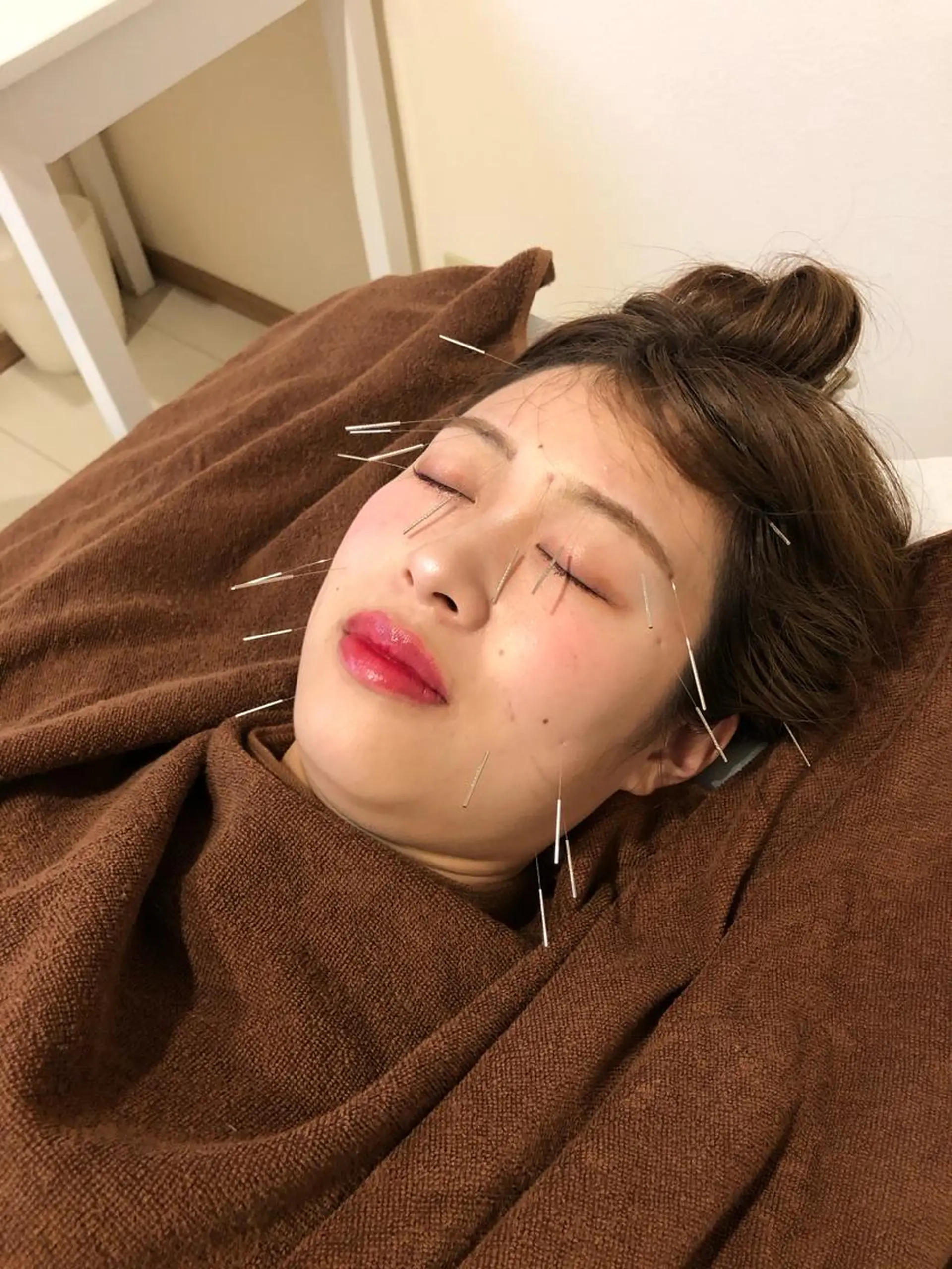 SBHメディカル美容サロン所属・🐱美容鍼・整体 SBHメディカル👍のエステ・リラクイメージ