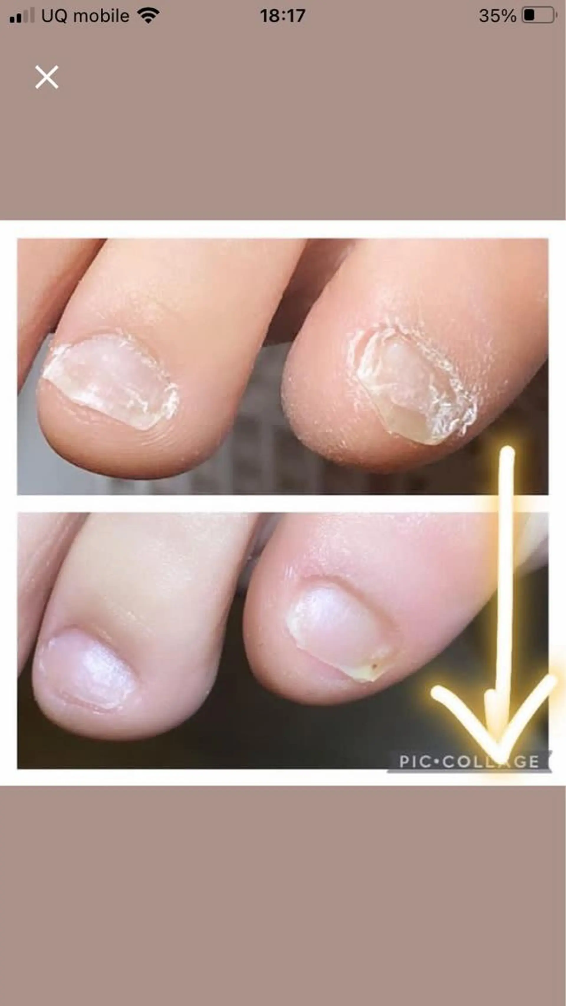 ネイル フットネイル atelier nife.のネイルデザイン