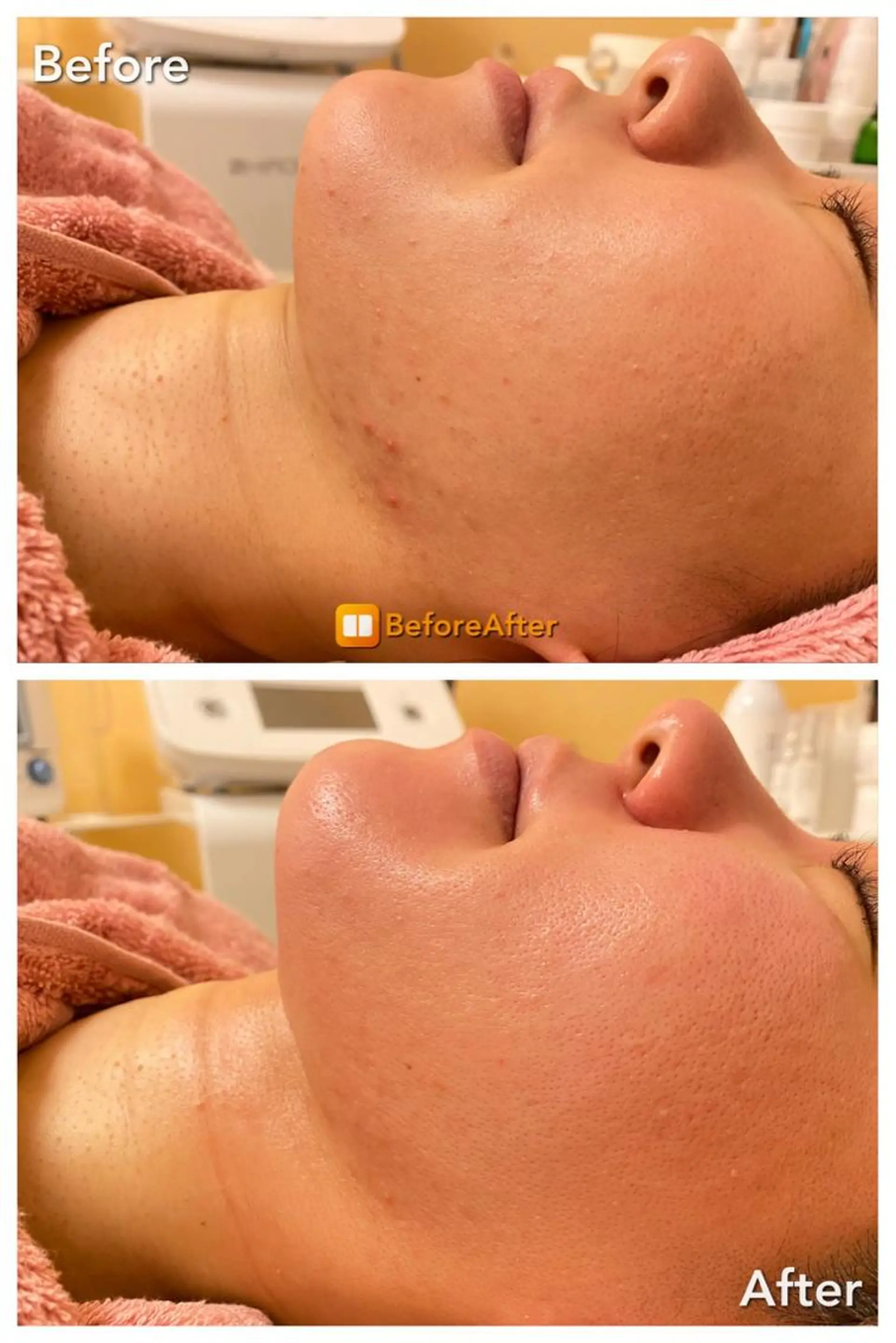 Lila プライベートサロンのエステ・リラクイメージ