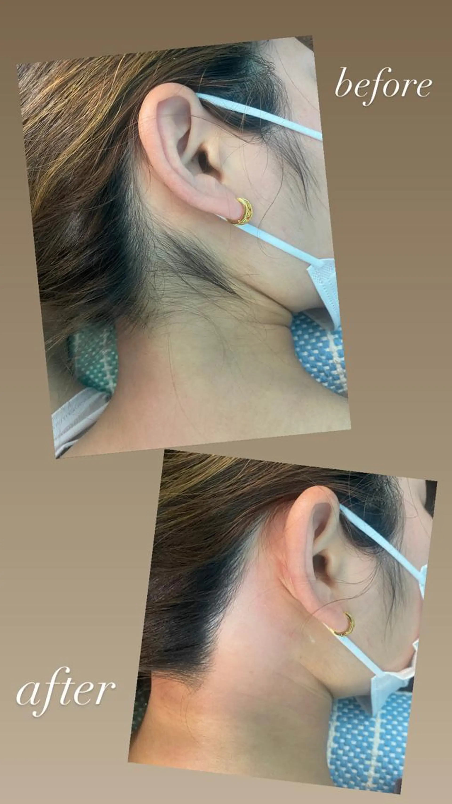 脱毛 maisbonita waxingのエステ・リラクイメージ